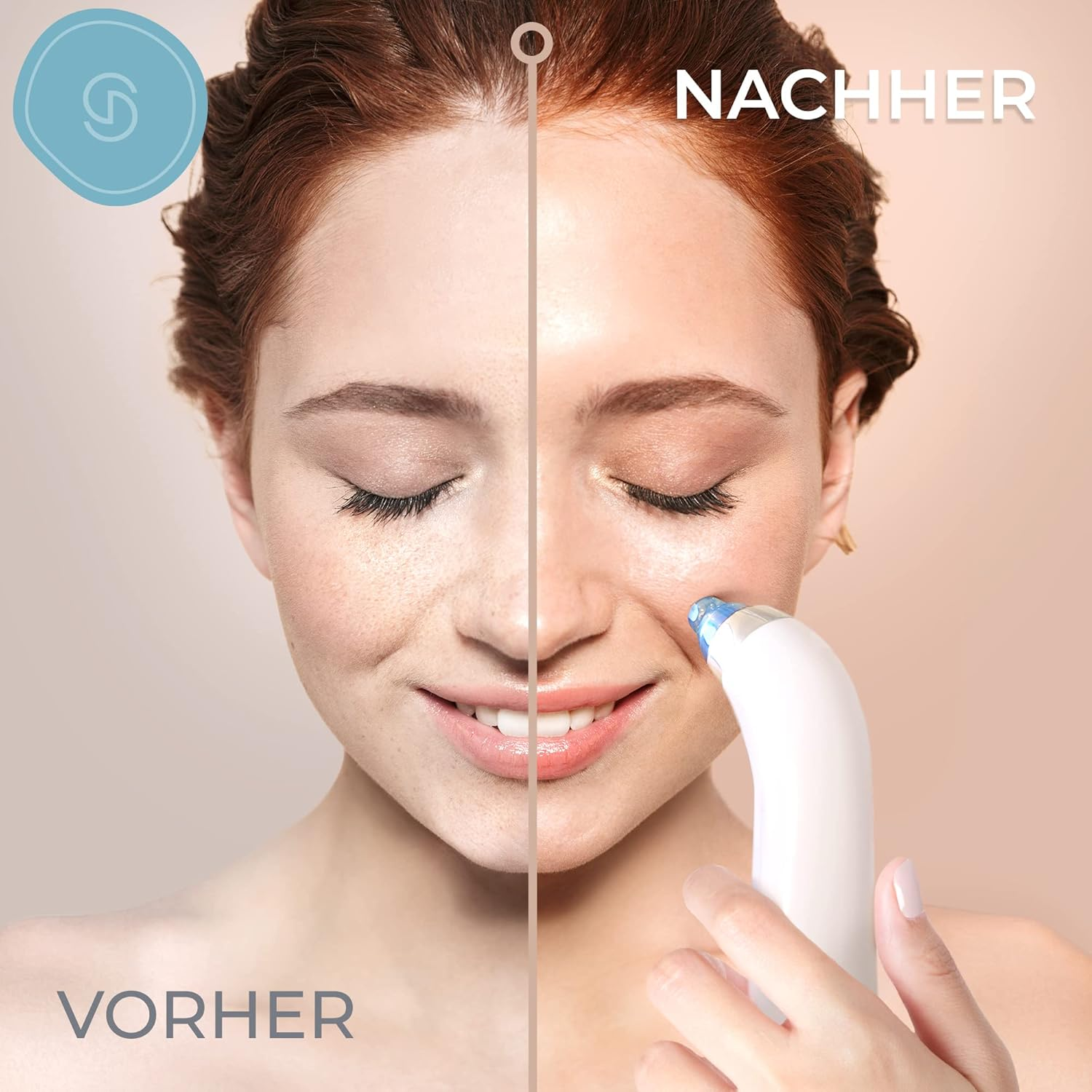 Vorher-Nachher-Vergleich einer Frau mit Hautpflegegerät, das die Haut verbessert.