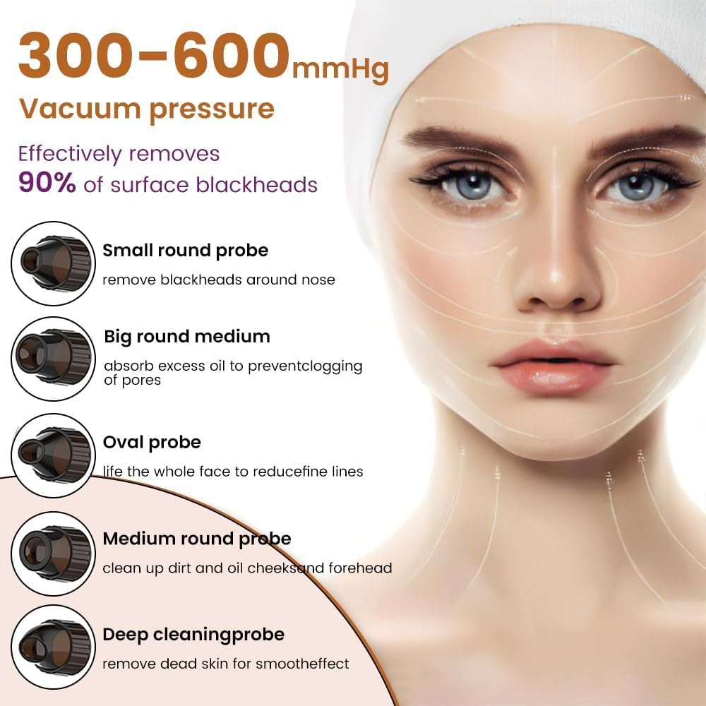 Gesichtsreiniger mit 4 Aufsätzen, Vakuumdruck 300-600 mmHg, entfernt 90% Mitesser.