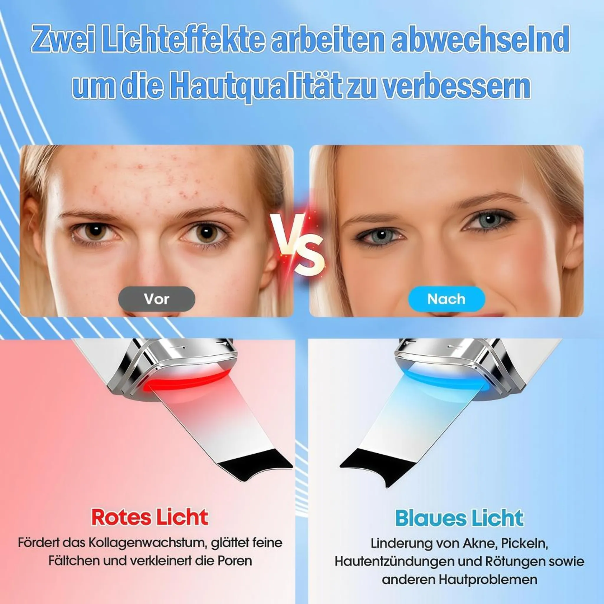 Vorher/Nachher Hautvergleich: Rotes Licht für Kollagen, blaues Licht für Akne.