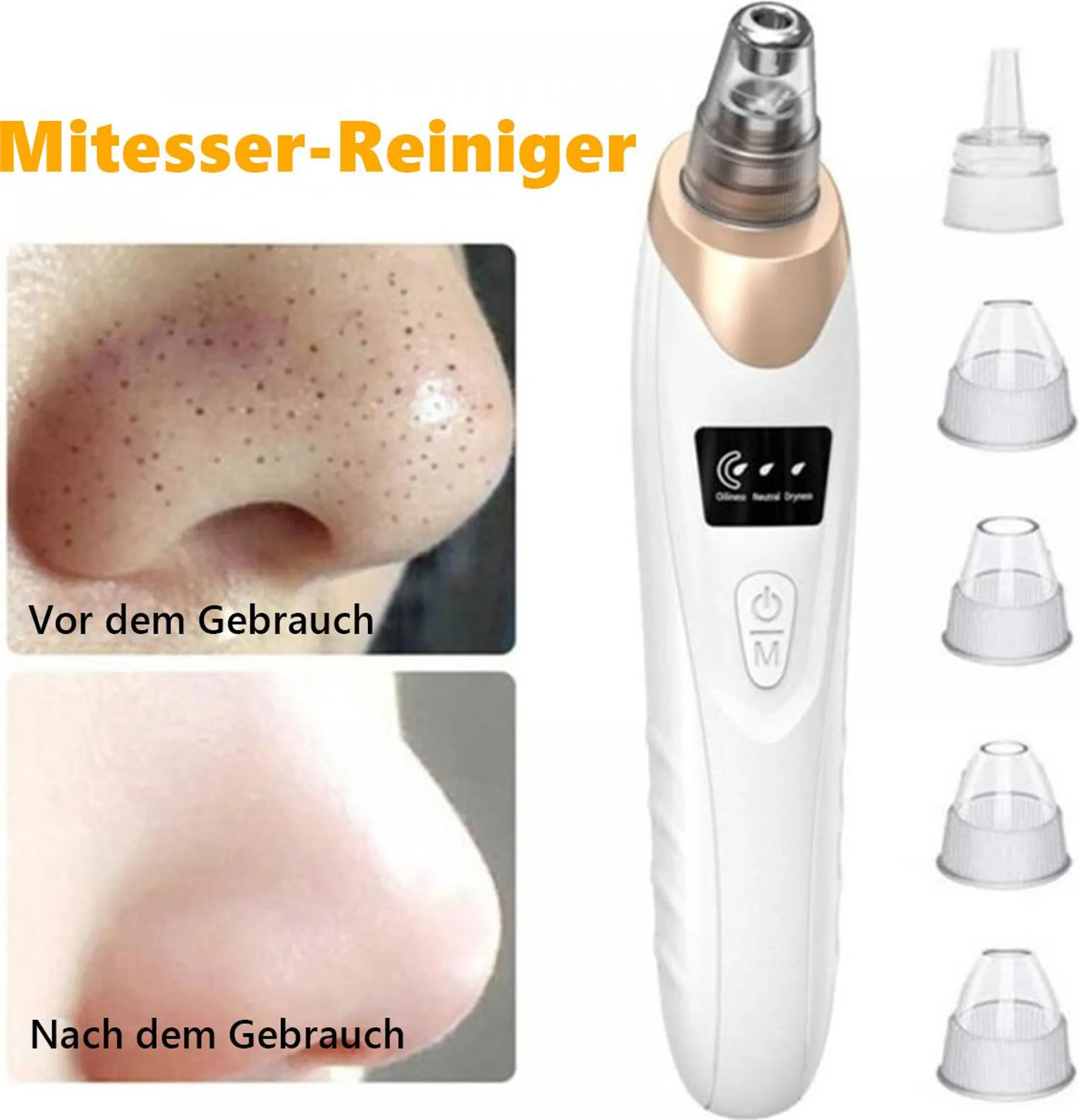 Vorher/Nachher-Vergleich einer Nase mit Mitessern und ein Hautpflegegerät.