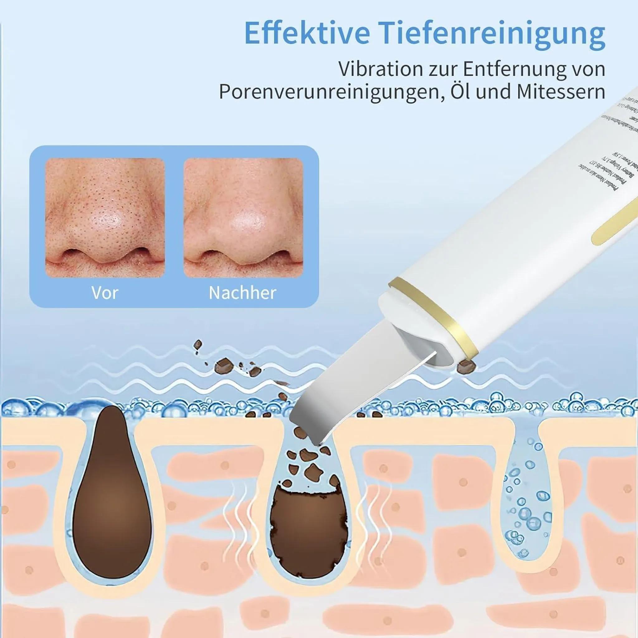 Vorher/Nachher-Bilder von Hautporen und ein Ultraschallreiniger, der Unreinheiten entfernt.