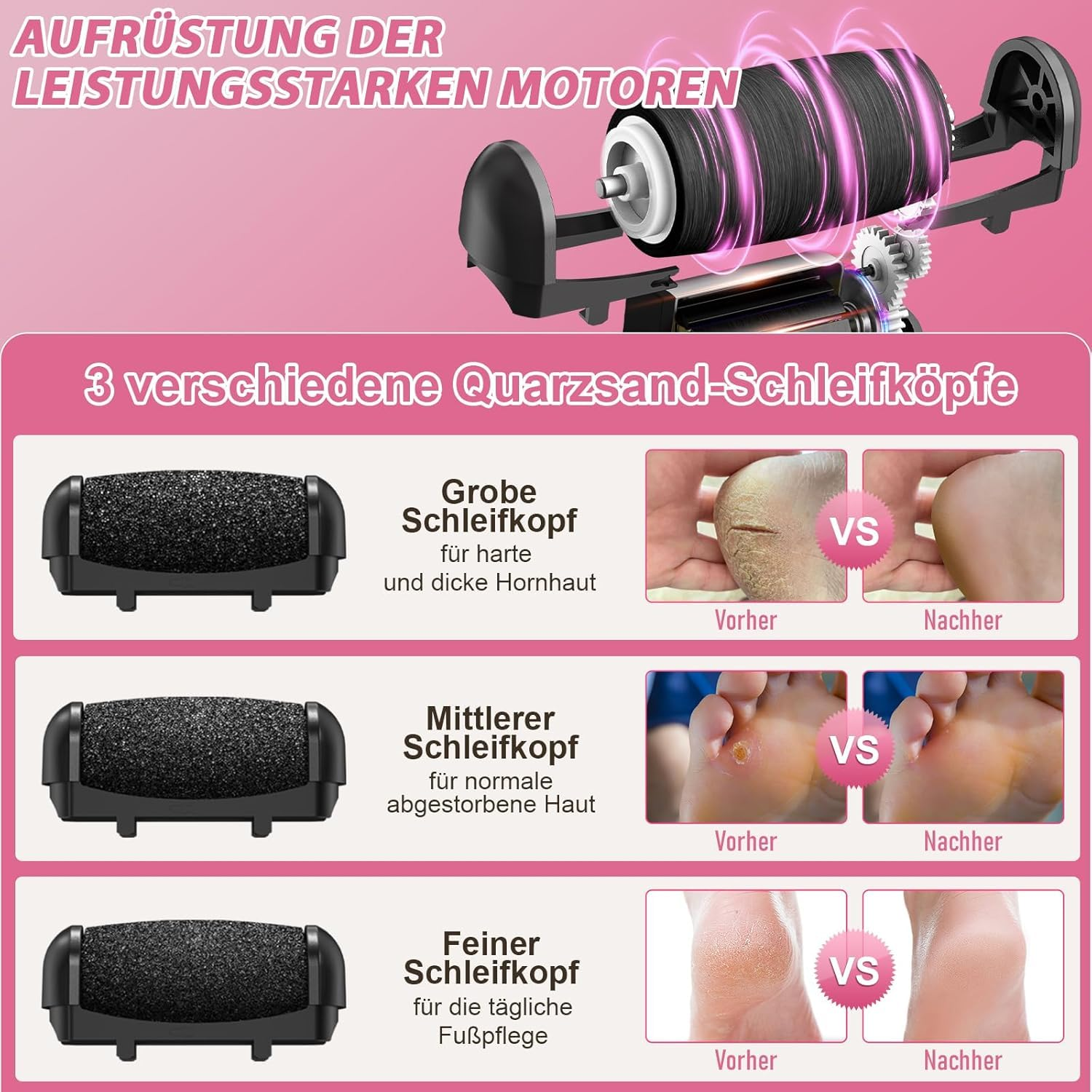 Drei Schleifköpfe für Füße: grob, mittel, fein. Vorher/Nachher-Bilder zeigen Ergebnisse.