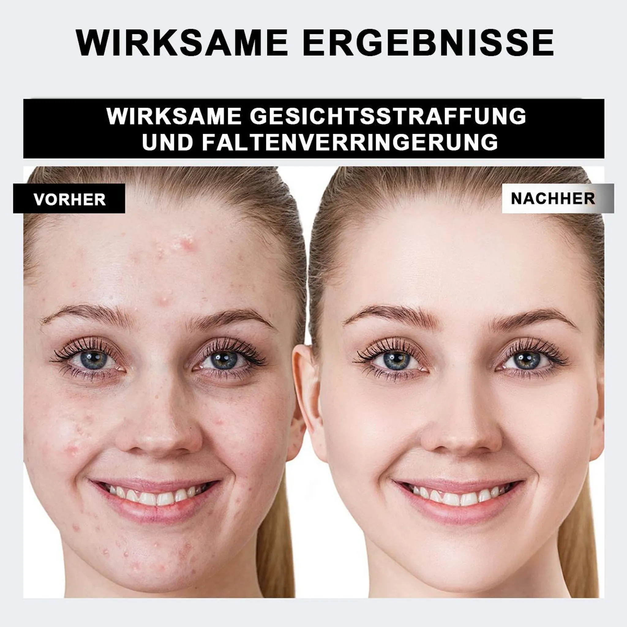 Vorher/Nachher-Gesichtsbild: Links unreine Haut, rechts reine Haut.