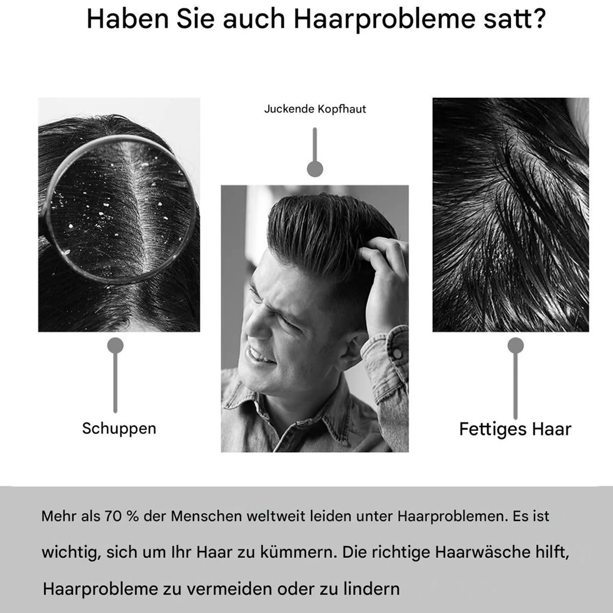 Bild zeigt Schuppen, juckende Kopfhaut und fettiges Haar als Haarprobleme.