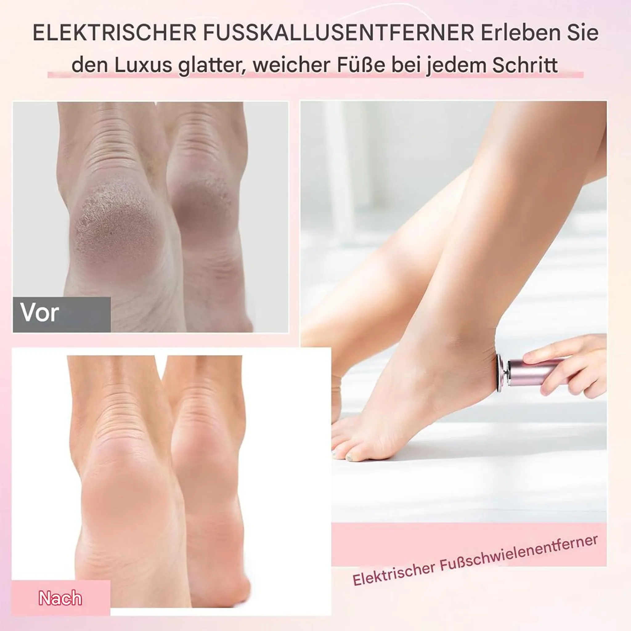 Vorher und Nachher: Füße mit Hornhaut und glatte Füße.