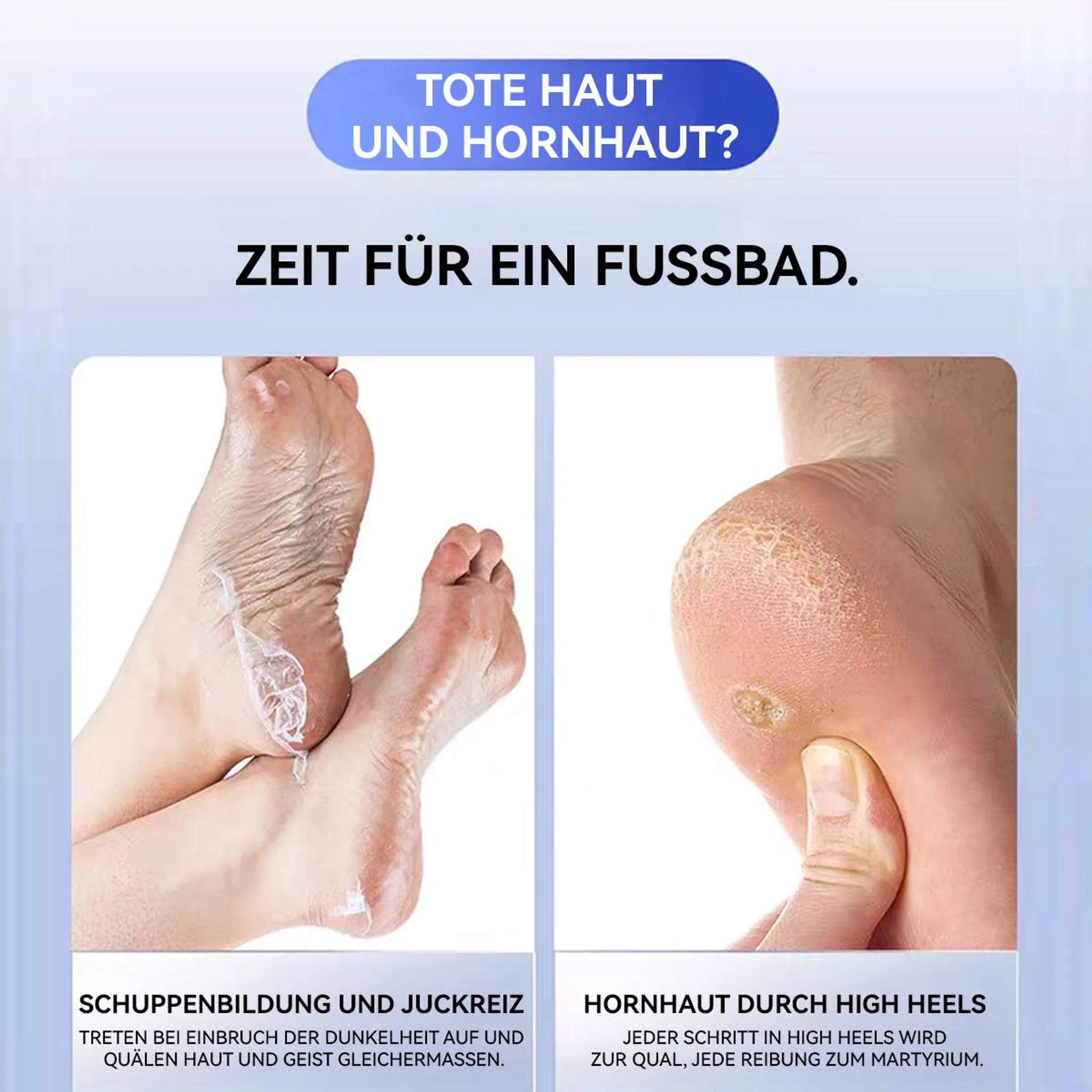 Trockene und Hornhaut an Füßen. Einer zeigt Hautschuppen, der andere Fersenhornhaut.