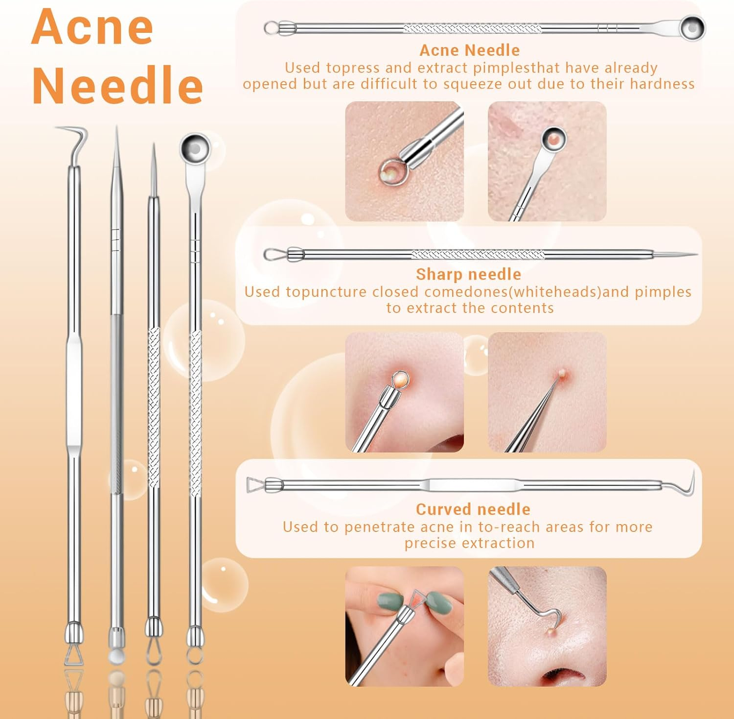 Acne-Nadel-Set mit verschiedenen Werkzeugen zur Hautpflege und Extraktion.