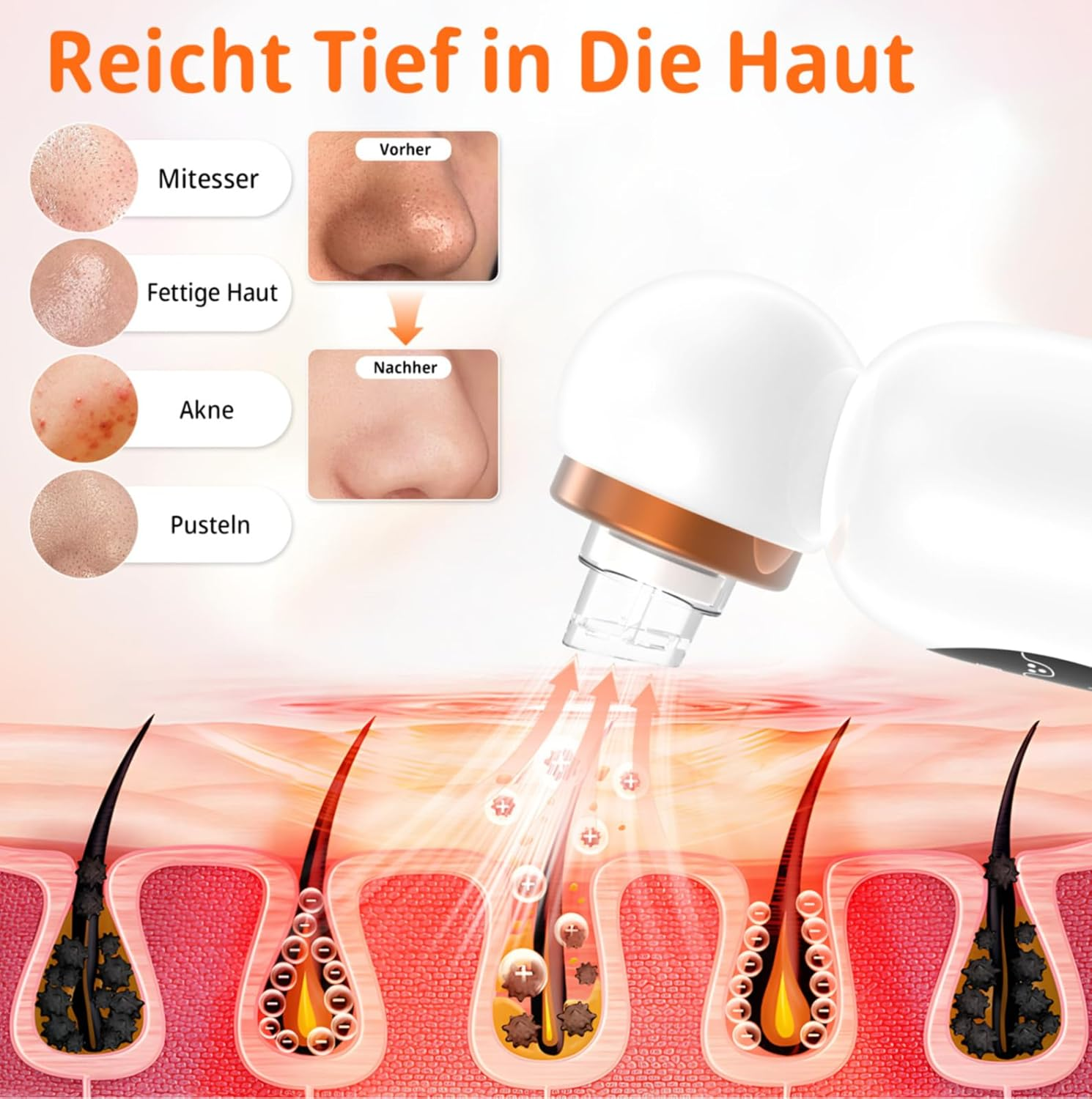 Illustration zeigt Hautprobleme und deren Behandlung mit einem Gerät.