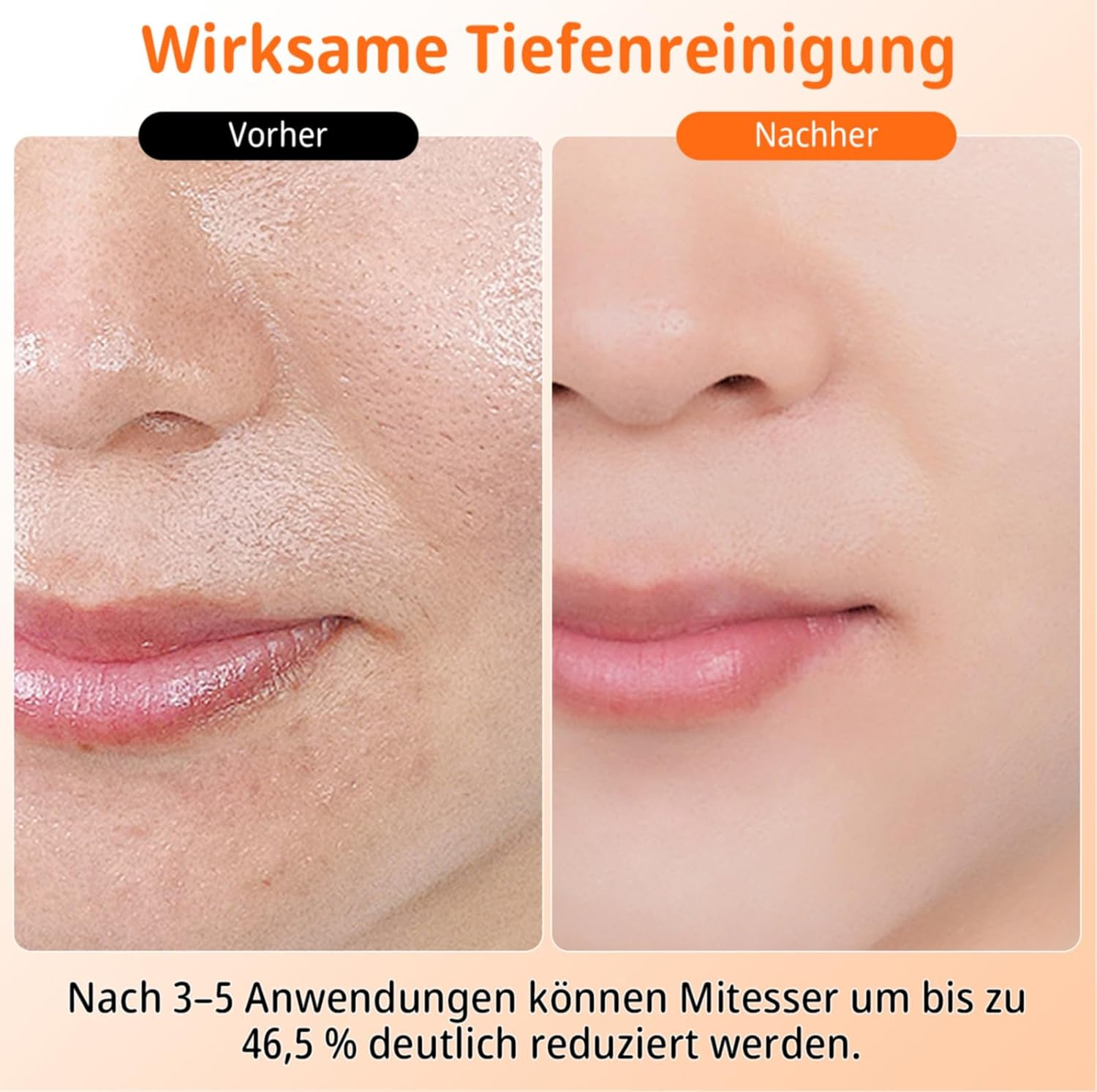 Vorher und nachher Hautbehandlung zeigt Porenreduktion. Text: Wirksame Tiefenreinigung.