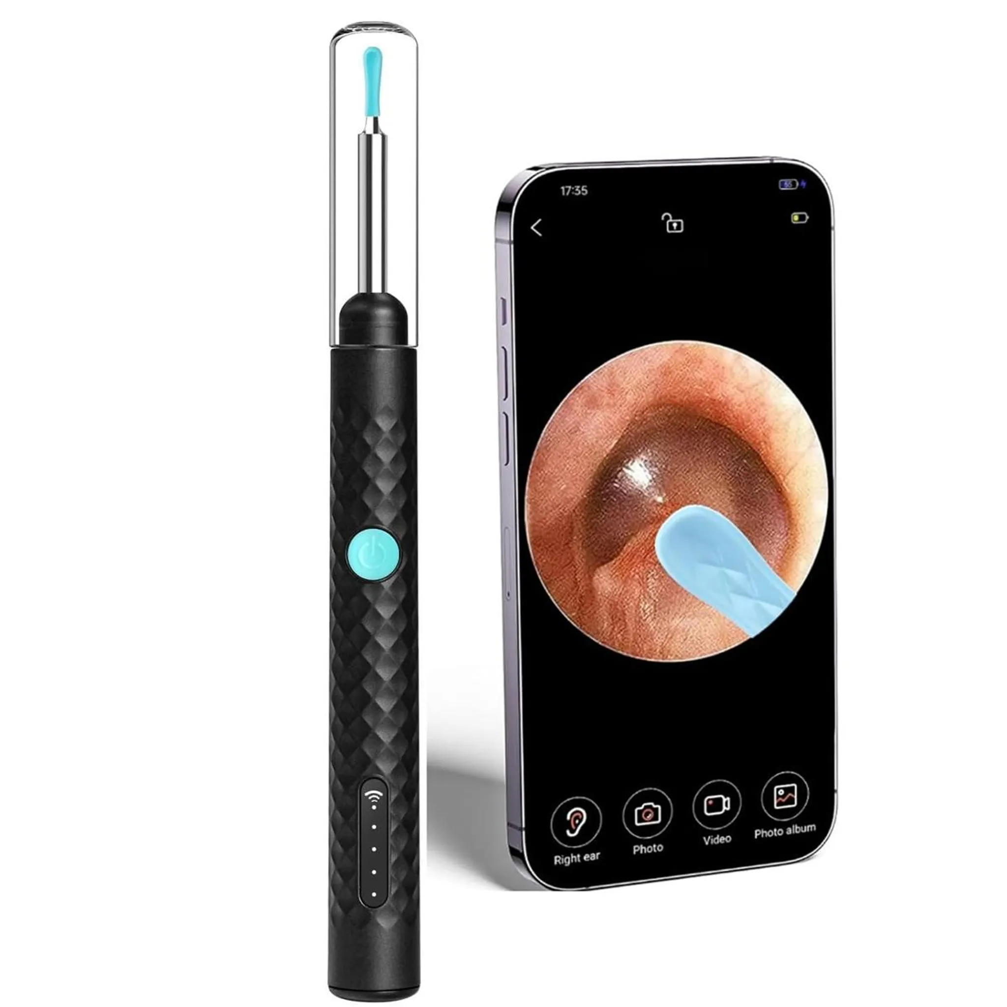 Ein schwarzer Ohrreiniger mit blauer Spitze neben einem Smartphone, das ein Ohr zeigt.