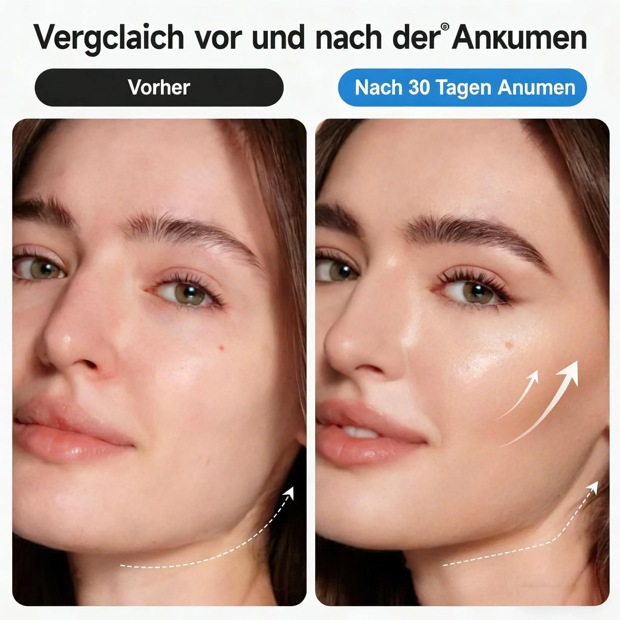 Vergleich vor und nach 30 Tagen: Gesichtshälfte links zeigt vorher, rechts nachher.
