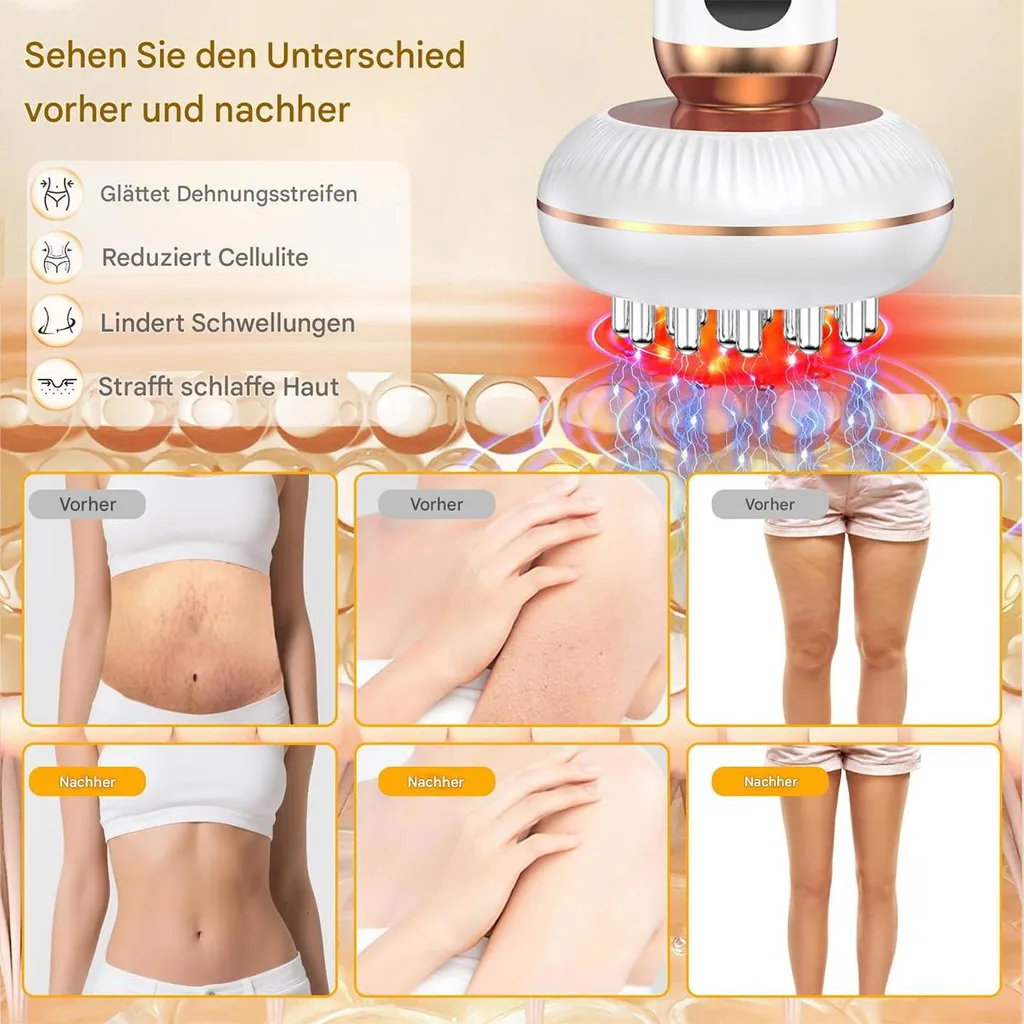 Vorher-Nachher-Bilder zeigen Hautverbesserungen: glattere Haut, weniger Cellulite.