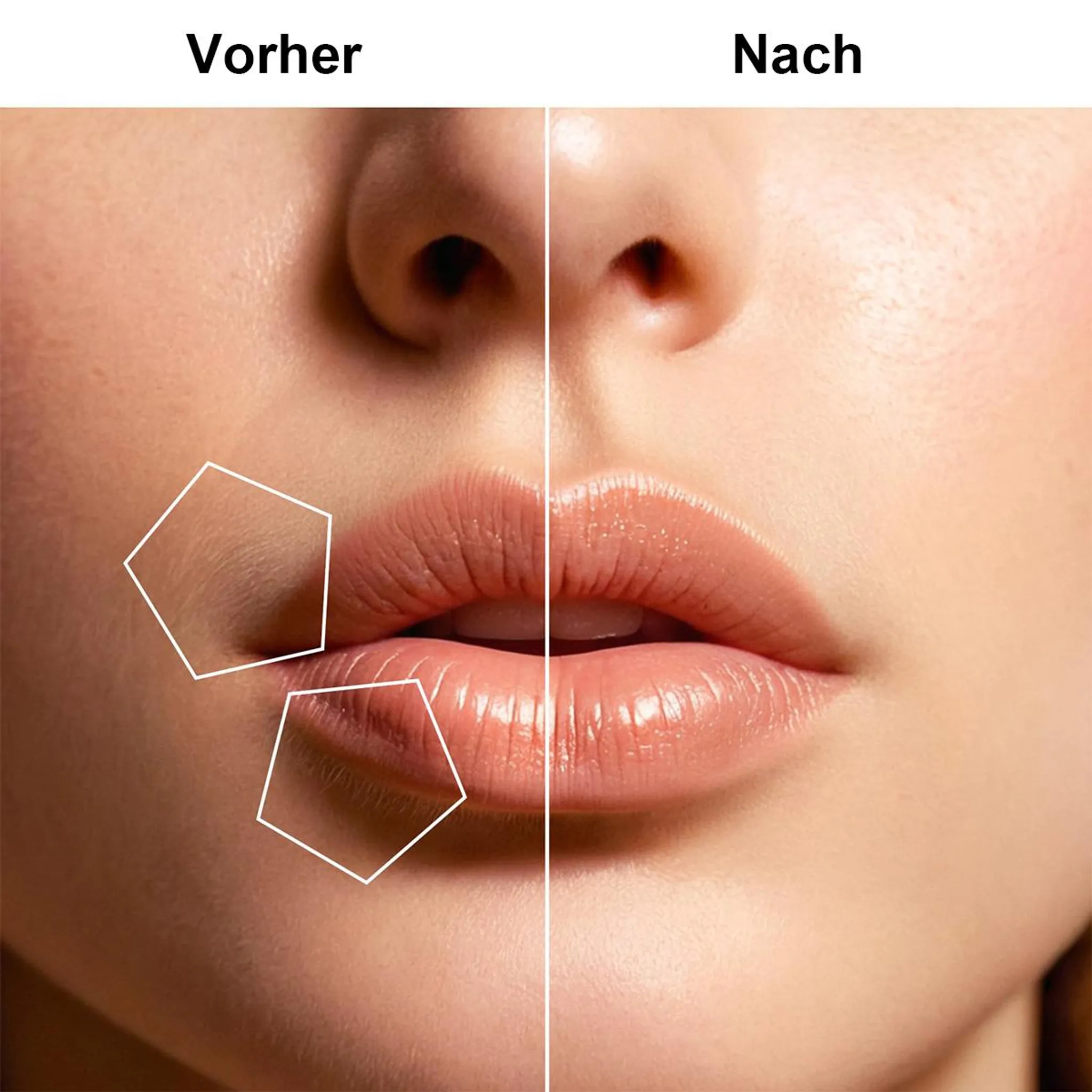 Vorher/Nachher-Vergleich von Lippen und Haut, mit weißen geometrischen Formen.