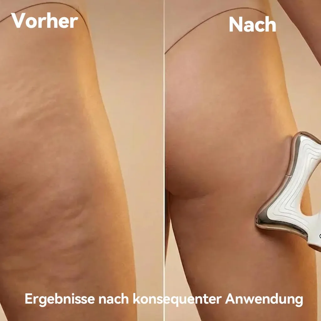 Vorher-Nachher-Vergleich einer Oberschenkelbehandlung mit Hauttexturverbesserung.