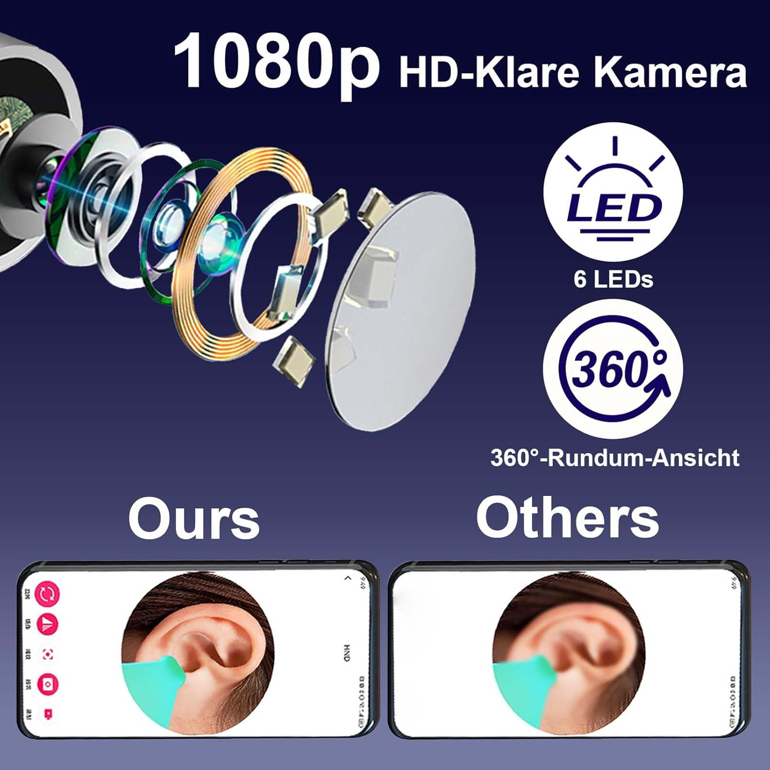 1080p HD Kamera mit 6 LEDs und 360° Ansicht. Vergleich von Ohrenansichten.