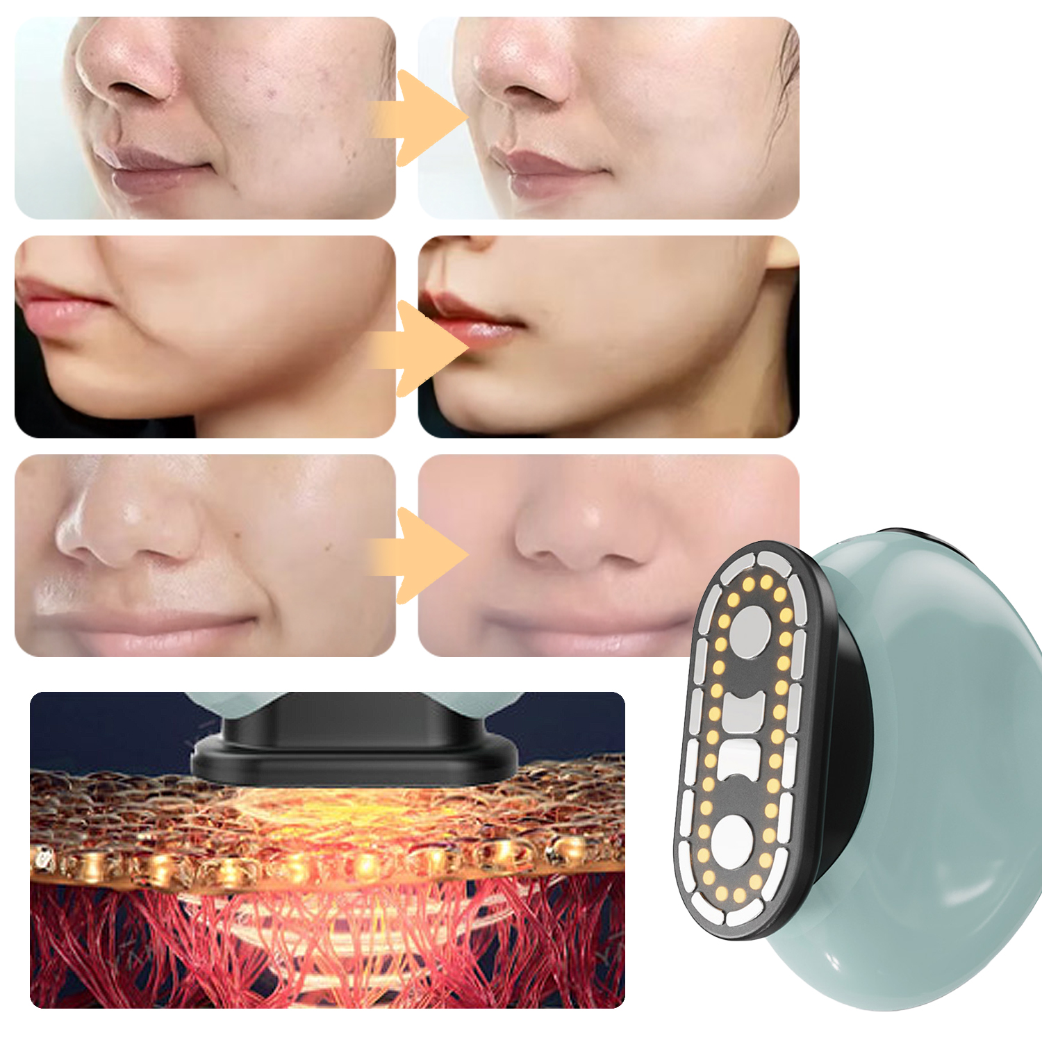 Trattamento viso prima e dopo: dispositivo skincare con luci e strati cutanei.
