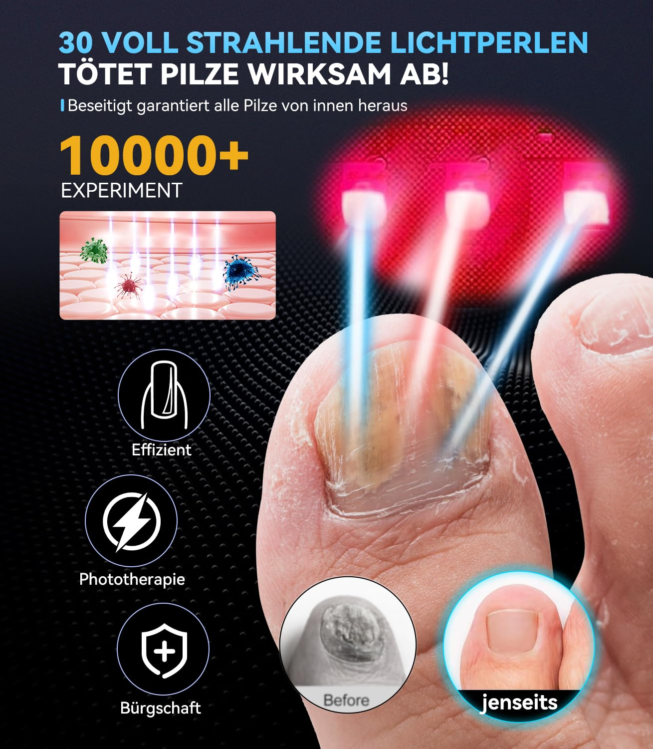 Zeigt eine Fußzehe mit Nagelpilz, behandelt mit Lichttherapie.