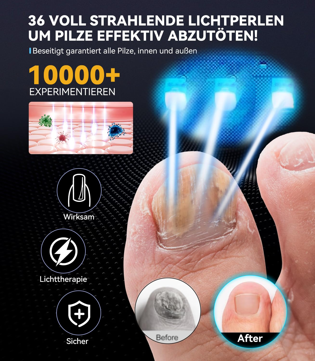 Zeigt Fußnagelpilz-Behandlung mit Lichttherapie, Vorher/Nachher-Vergleich.