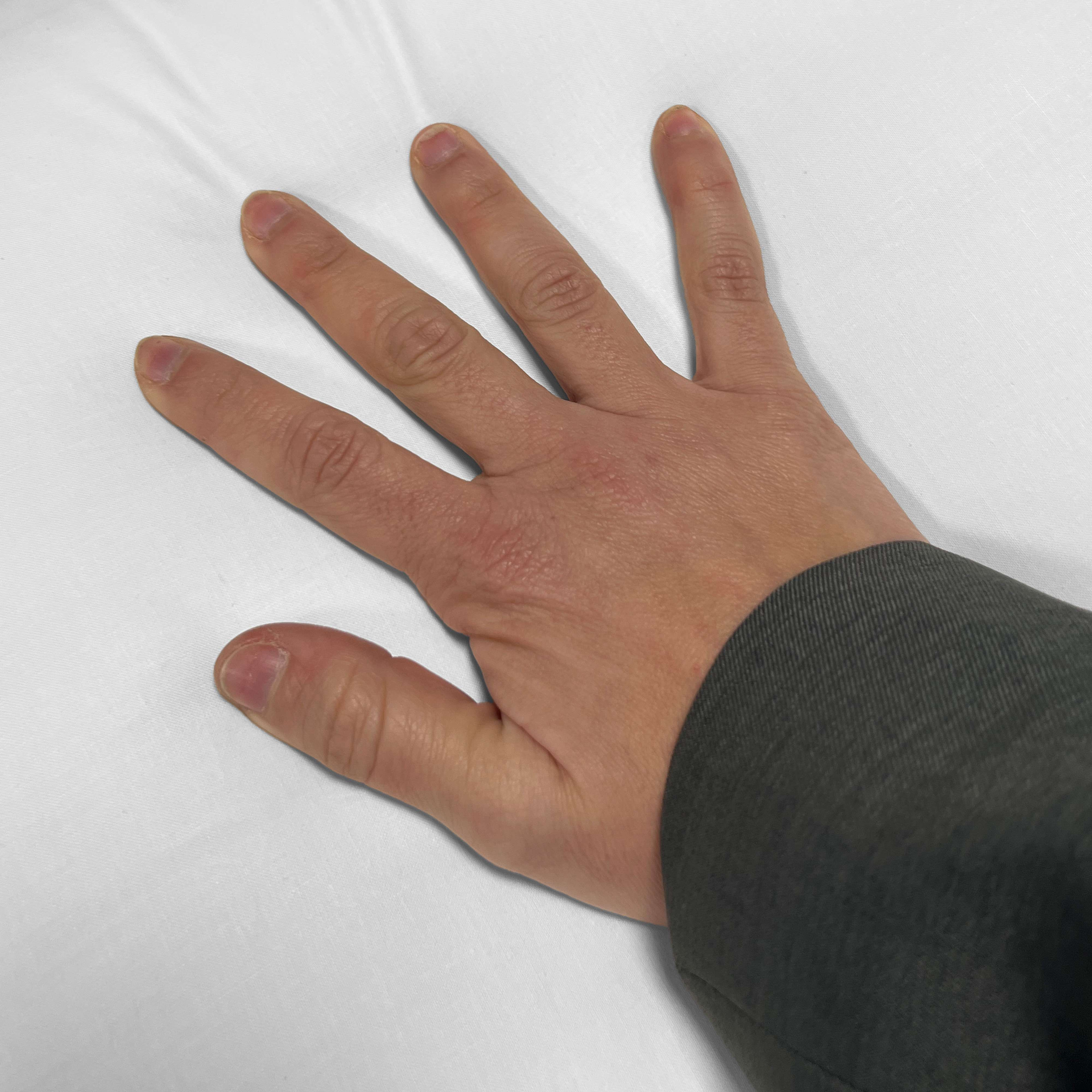 Una mano con los dedos extendidos yace sobre tela blanca. Se ve una chaqueta gris.