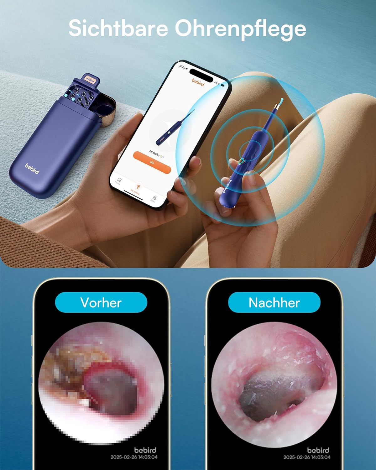 Ein lila Behandlungsset mit Smartphone und Ohr-Kamera-Ansichten.