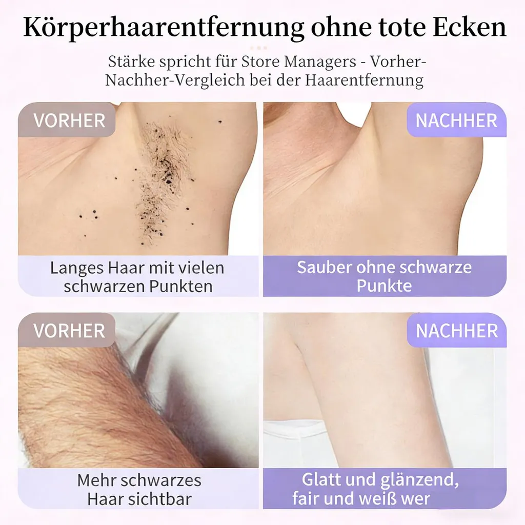 Vorher-Nachher-Vergleich von Körperhaarentfernung an Achseln und Armen.
