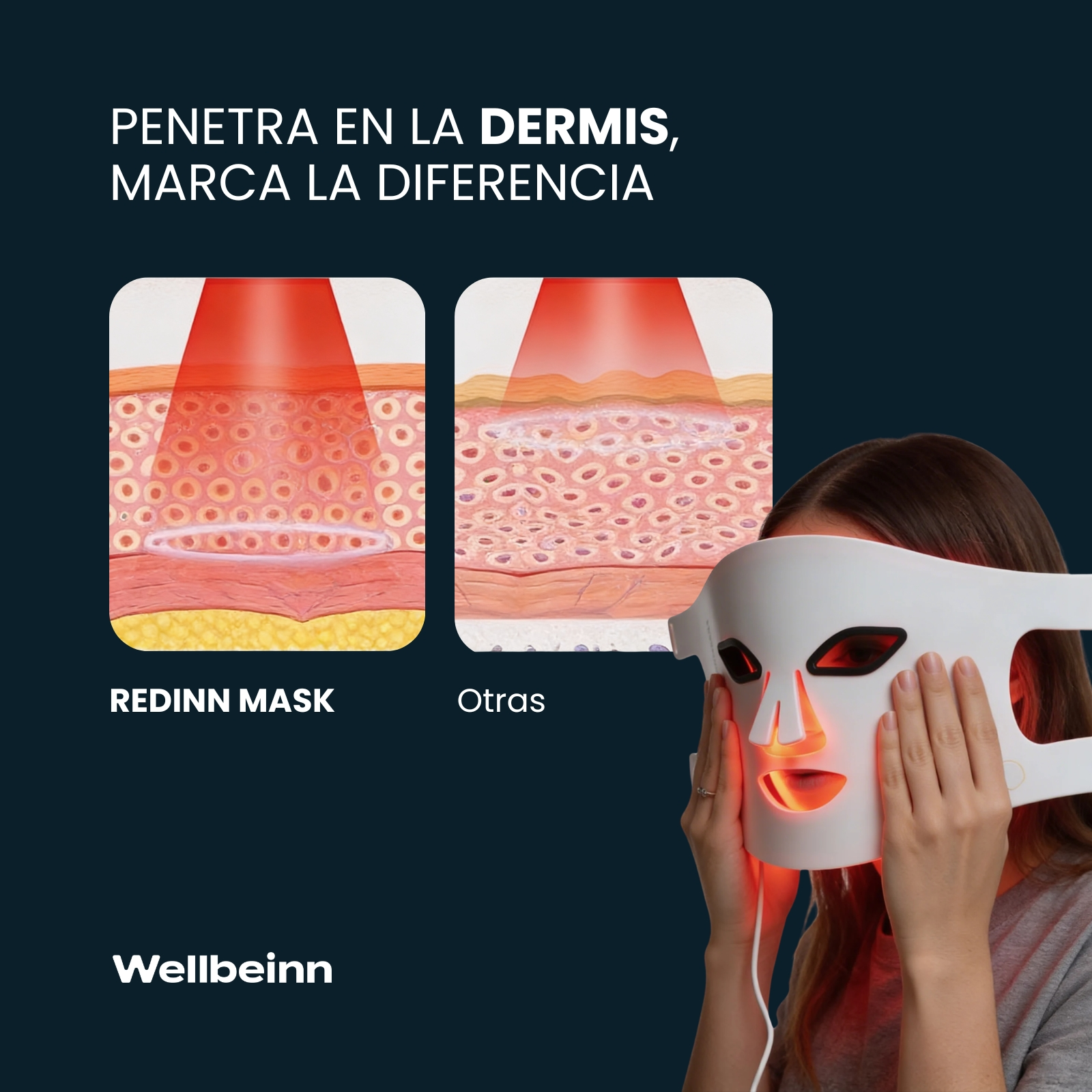 Una mujer usa una mascarilla facial LED blanca. Ilustración de capa de piel a la izquierda.