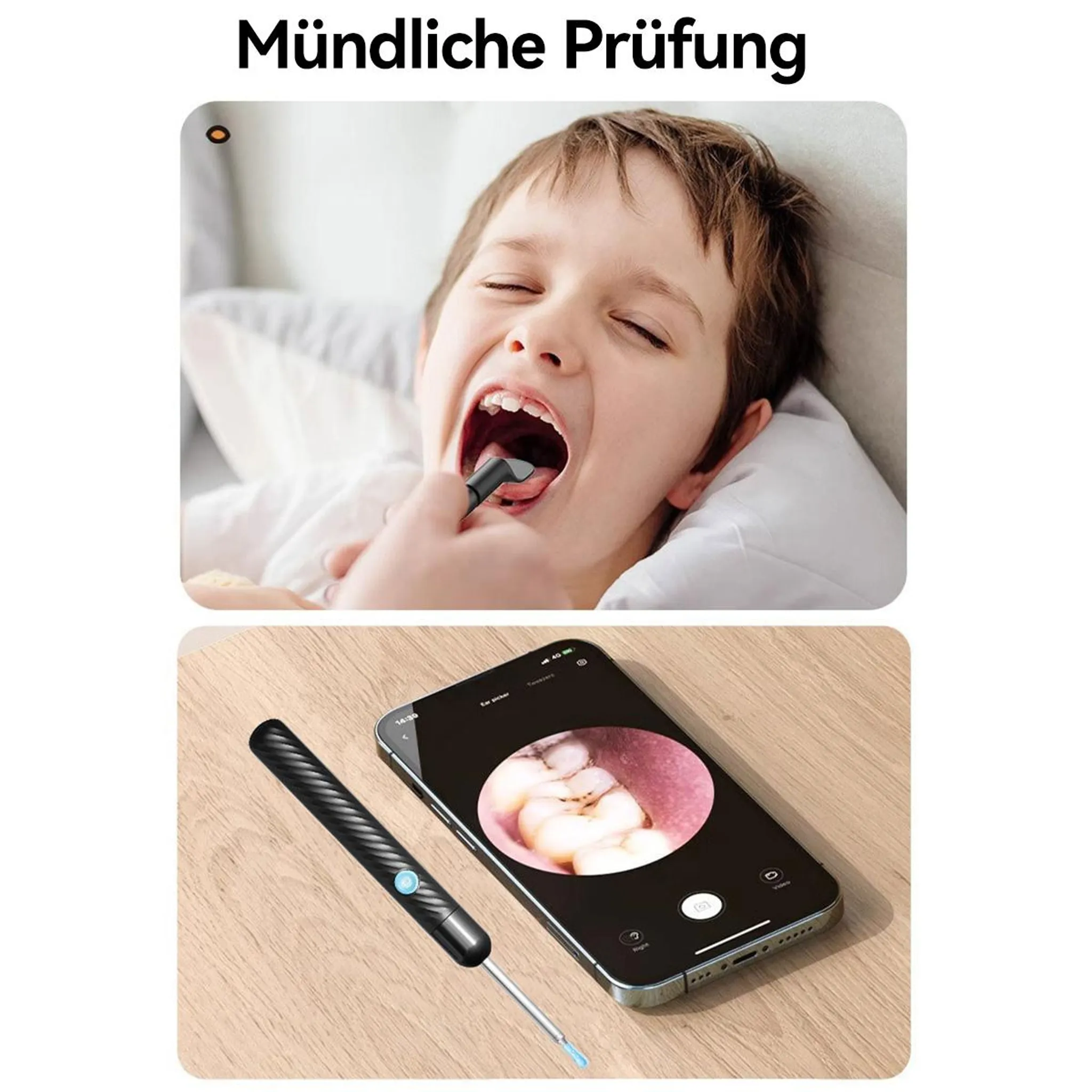 Ein Kind öffnet den Mund, ein Gerät wird eingeführt. Handy zeigt Zähne.