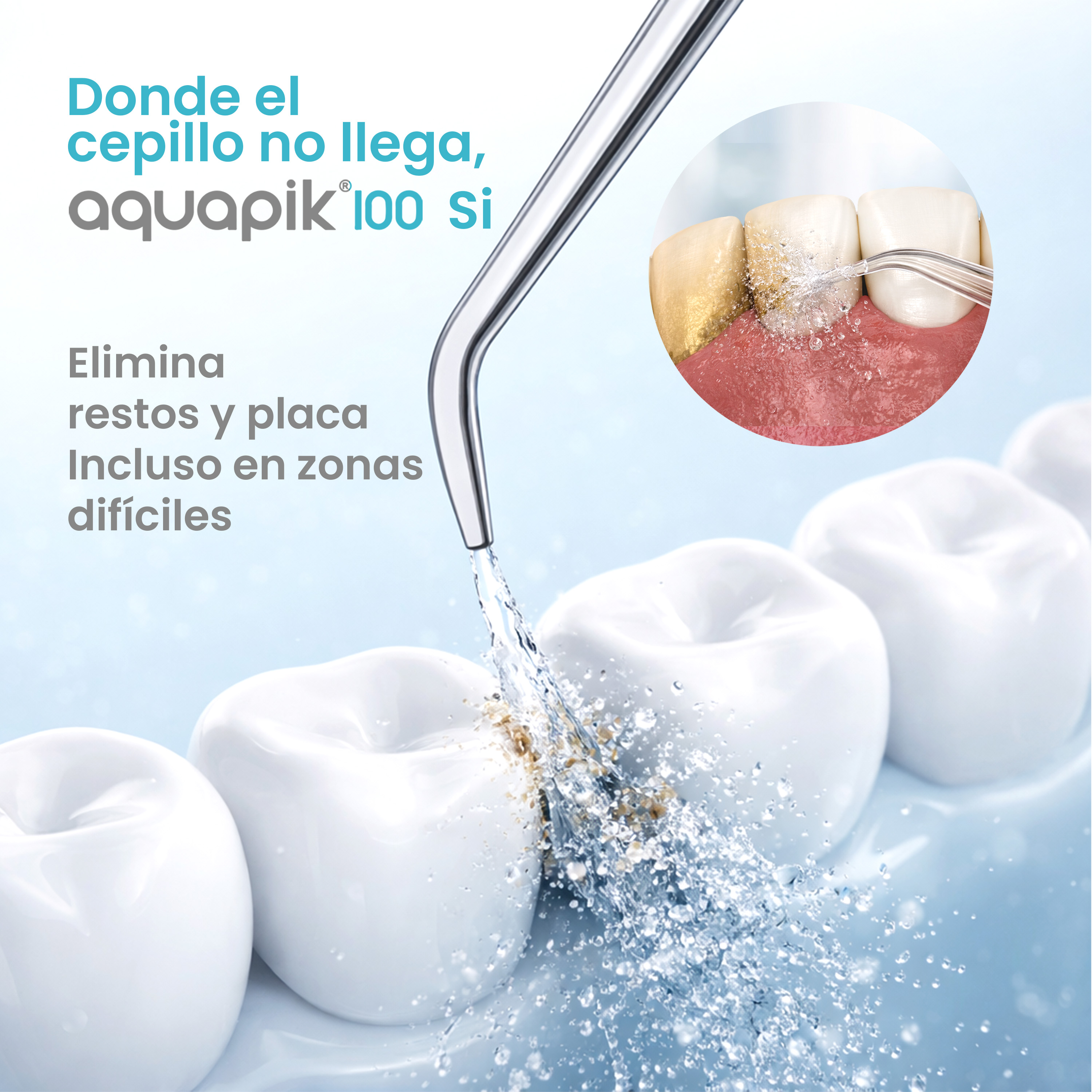 Un getto d'acqua pulisce i denti da placca e residui.