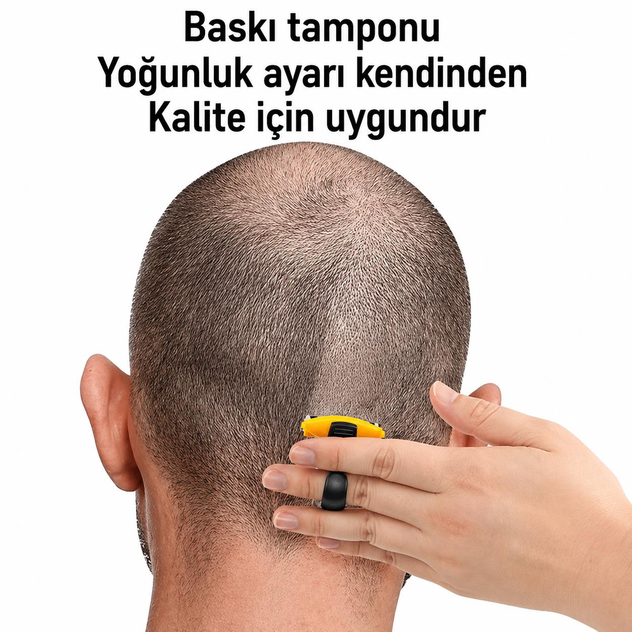 Siyah yüzüklü bir el, bir kişinin ensesinde sarı bir düzeltici tutuyor.