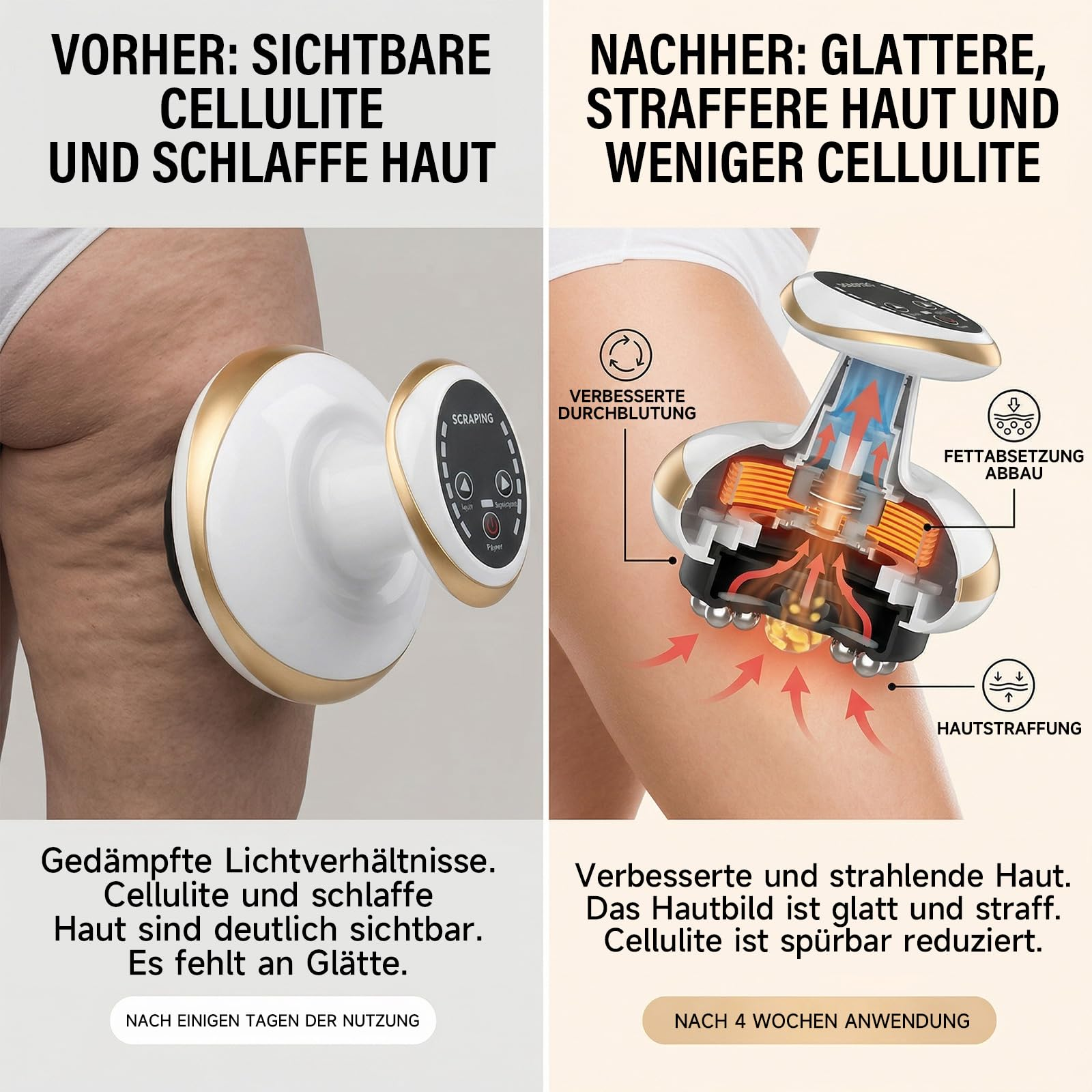 Vorher: Cellulite und schlaffe Haut. Nachher: Glattere Haut und weniger Cellulite.