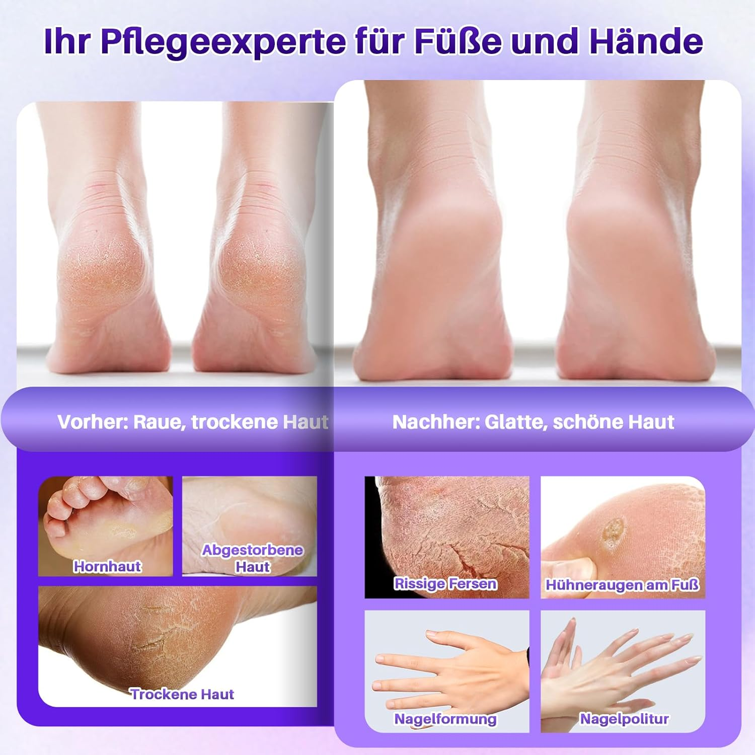 Vorher/Nachher-Vergleich von Fuß- und Handpflege: Trockene, rissige Haut wird geglättet.