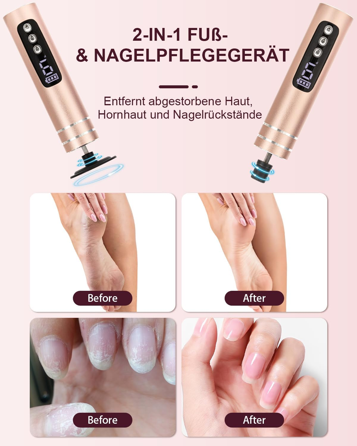Ein 2-in-1 Fuß- und Nagelpflegegerät mit Vorher/Nachher-Bildern von Füßen und Nägeln.