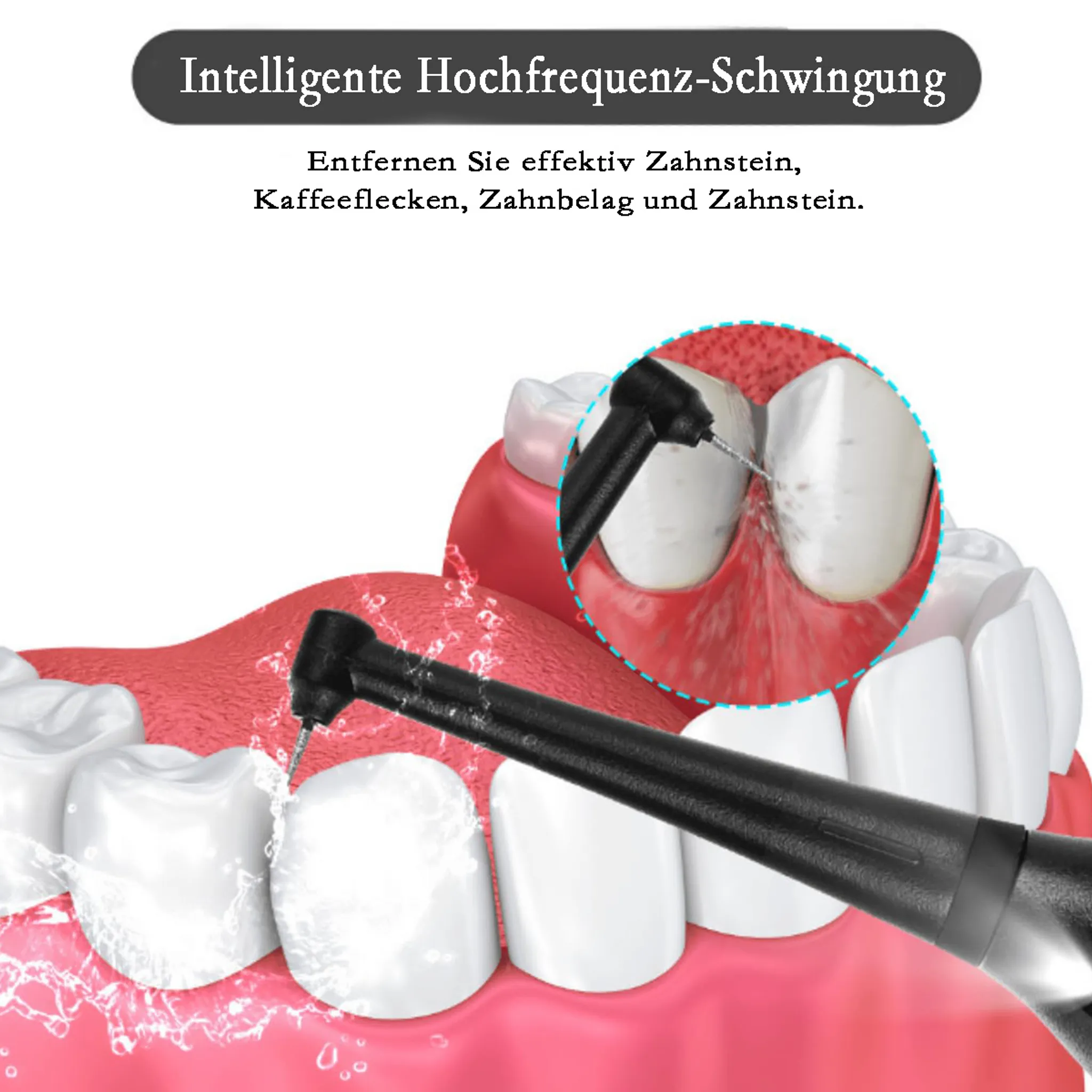 Ein zahnärztliches Werkzeug reinigt Zähne von Zahnstein und Belag.