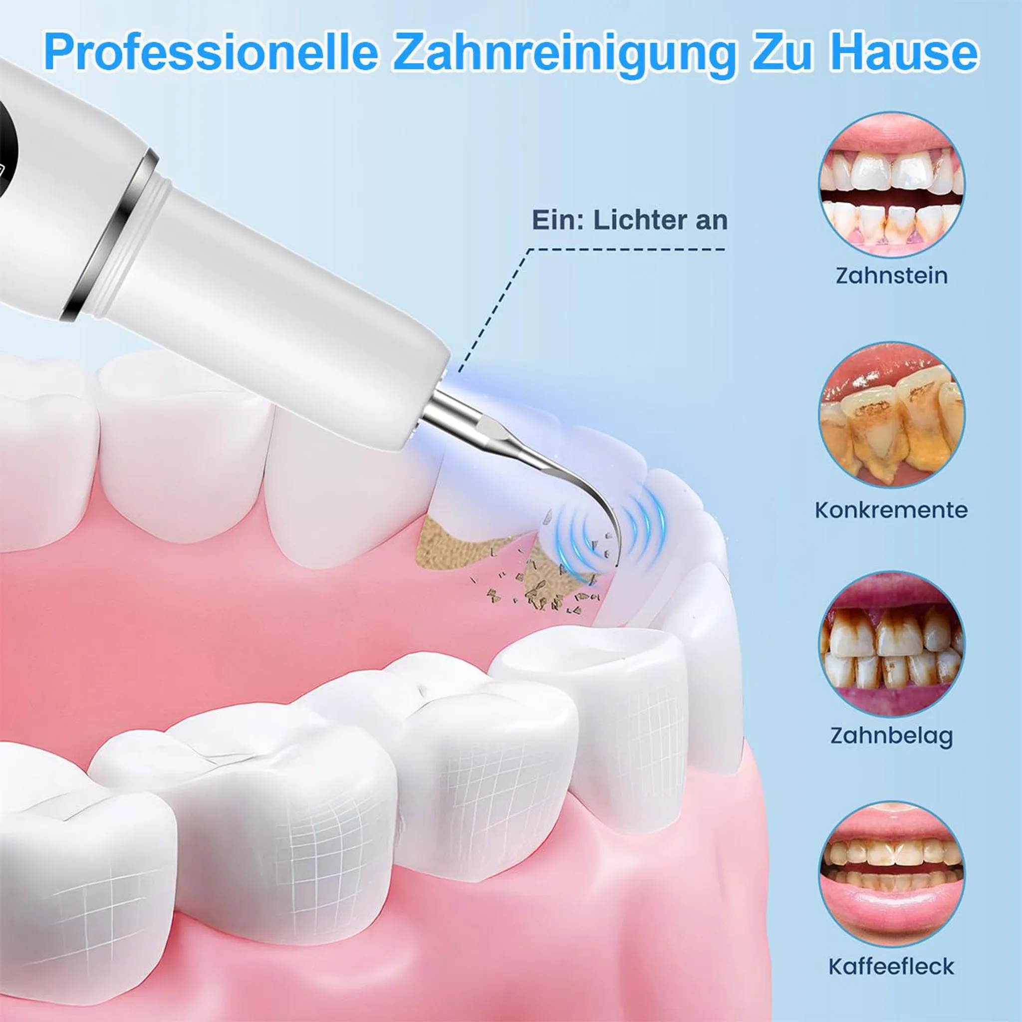 Zahnreiniger entfernt Zahnstein, Konkremente, Zahnbelag und Kaffeeflecken.