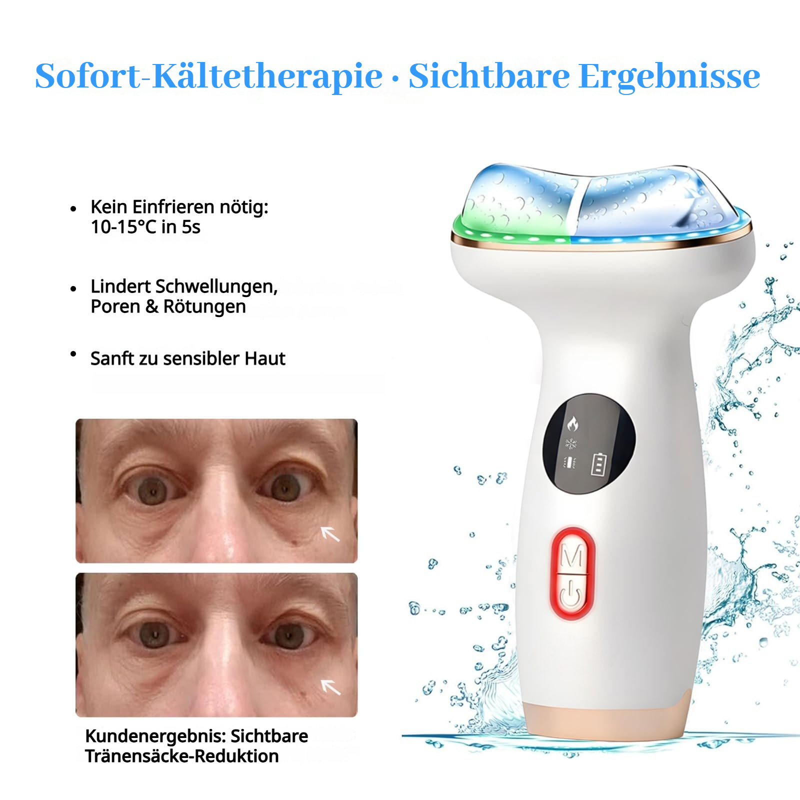 Kühlendes Hautpflegegerät mit Vorher-Nachher-Bildern von Augenpartien.