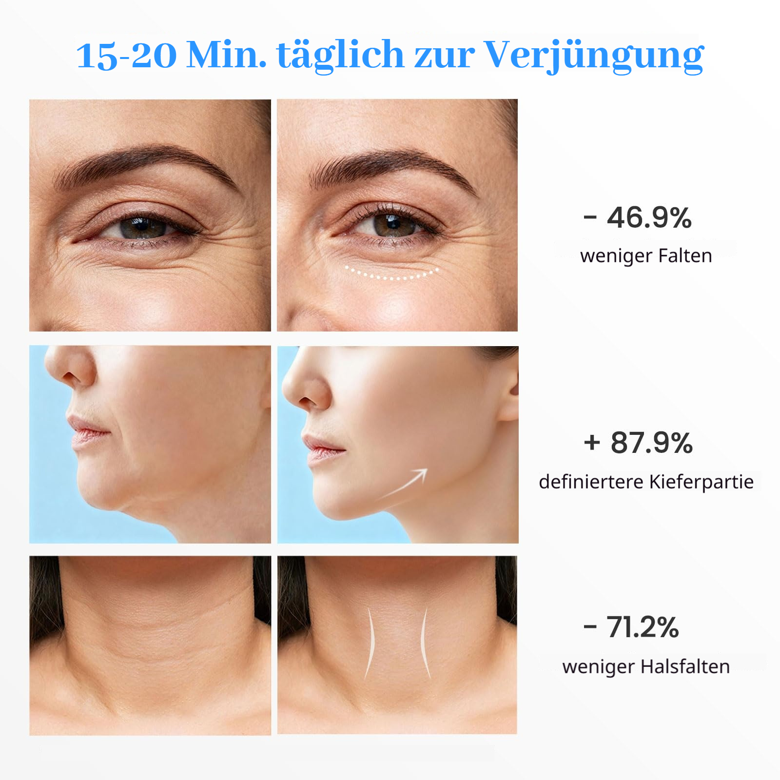 Vorher/Nachher-Bilder zeigen Hautverjüngung im Gesicht, Kiefer und Hals.