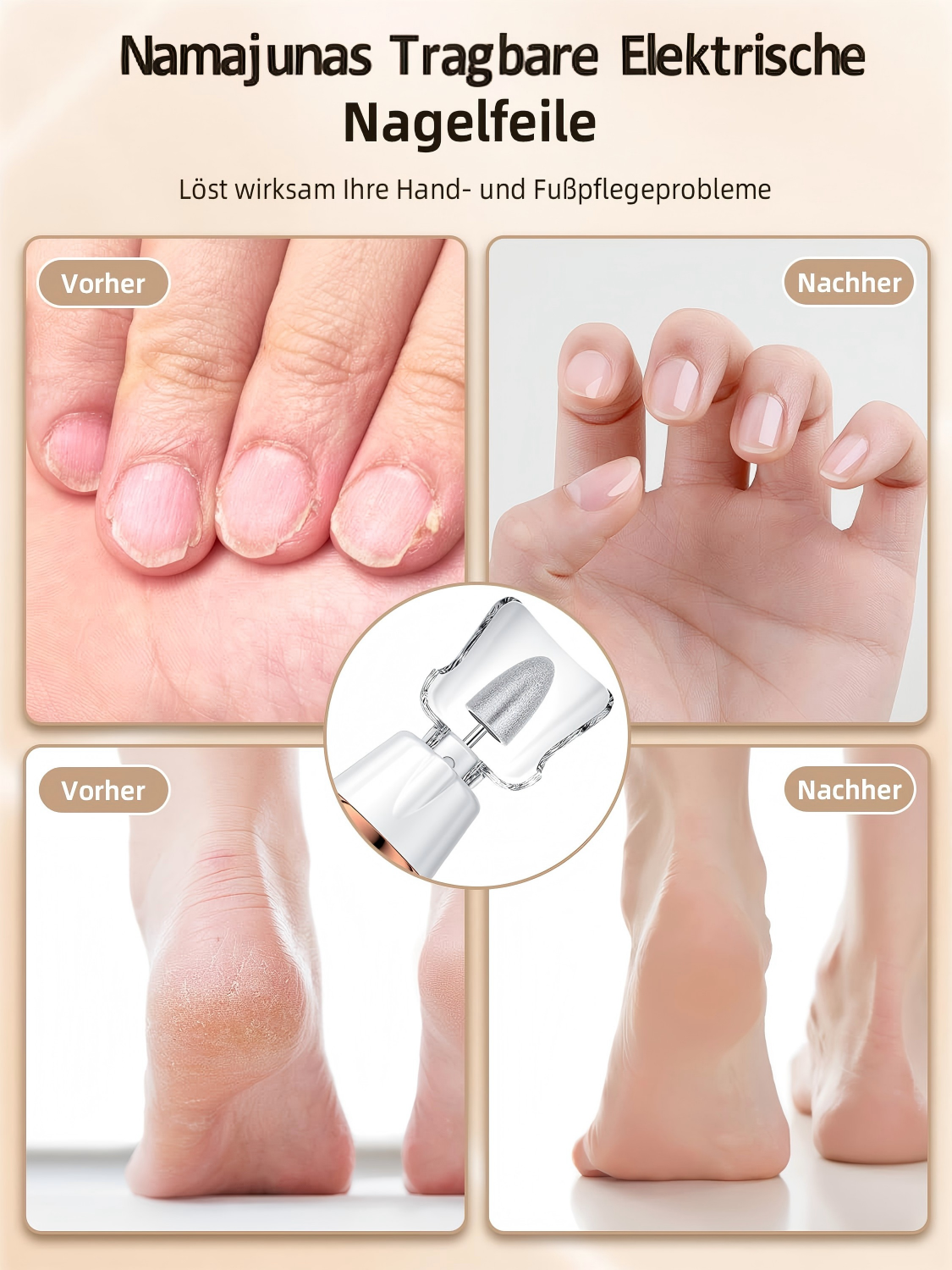 Vorher/Nachher-Vergleich von Händen und Füßen mit elektrischer Nagelfeile.