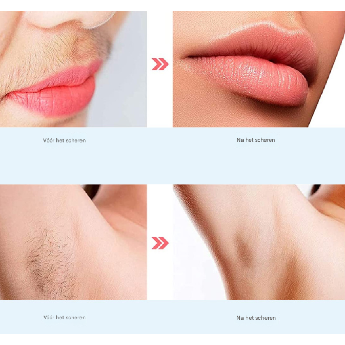 Vorher/Nachher-Bilder von Lippen und Achselhöhlen mit Haarentfernung.