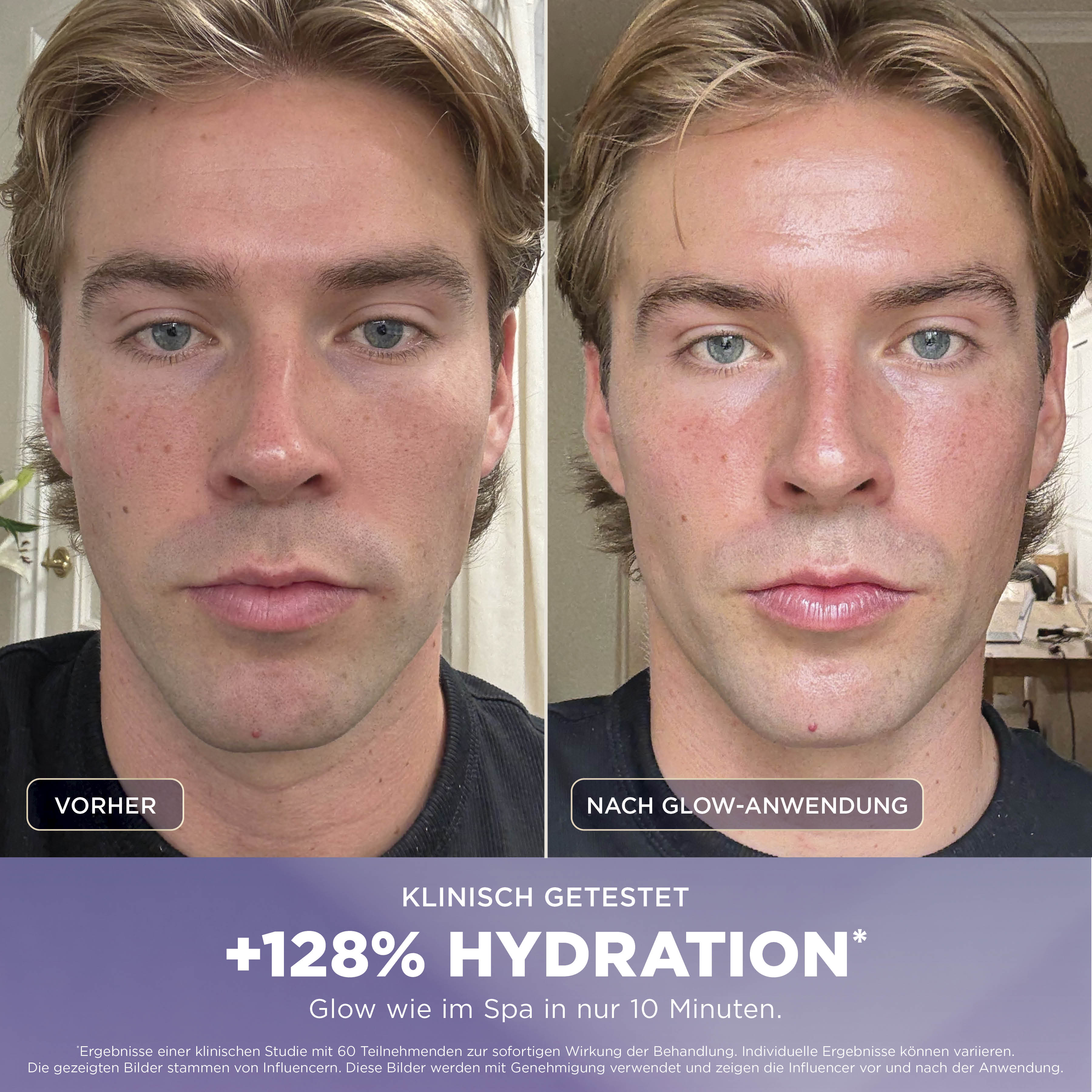 Comparaison avant/après d'un homme montrant +128% d'hydratation.