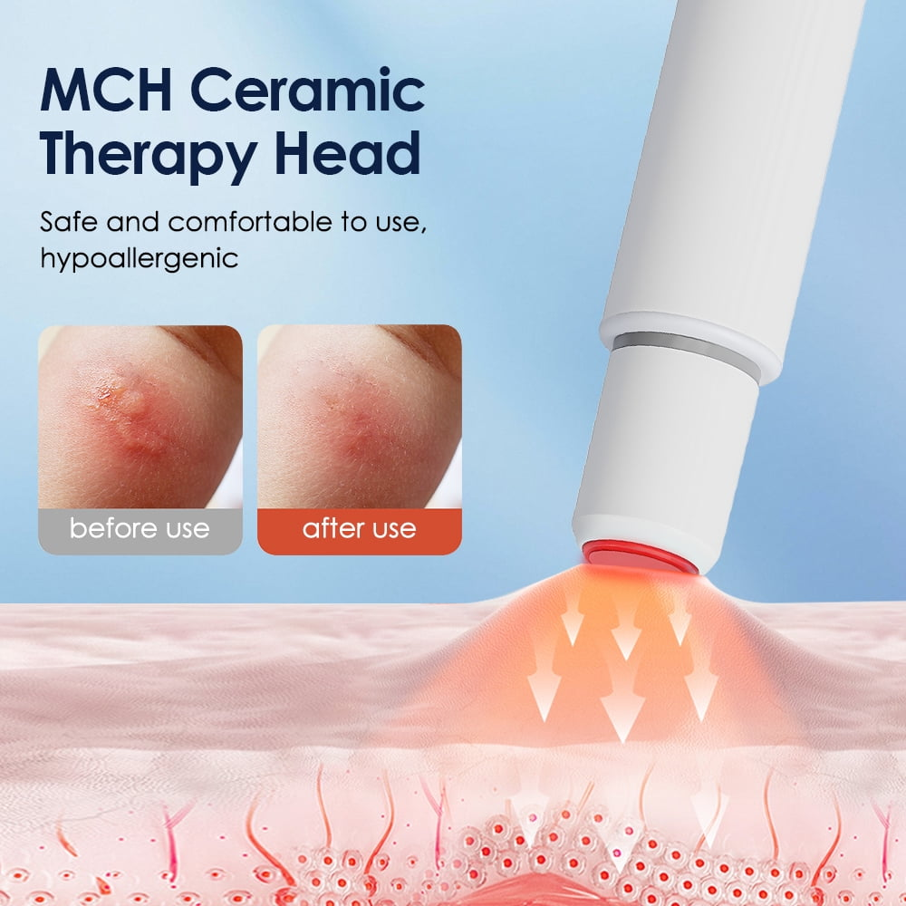 MCH Keramik Therapie Kopf zeigt Vorher/Nachher-Hautbilder und eine Nahaufnahme.