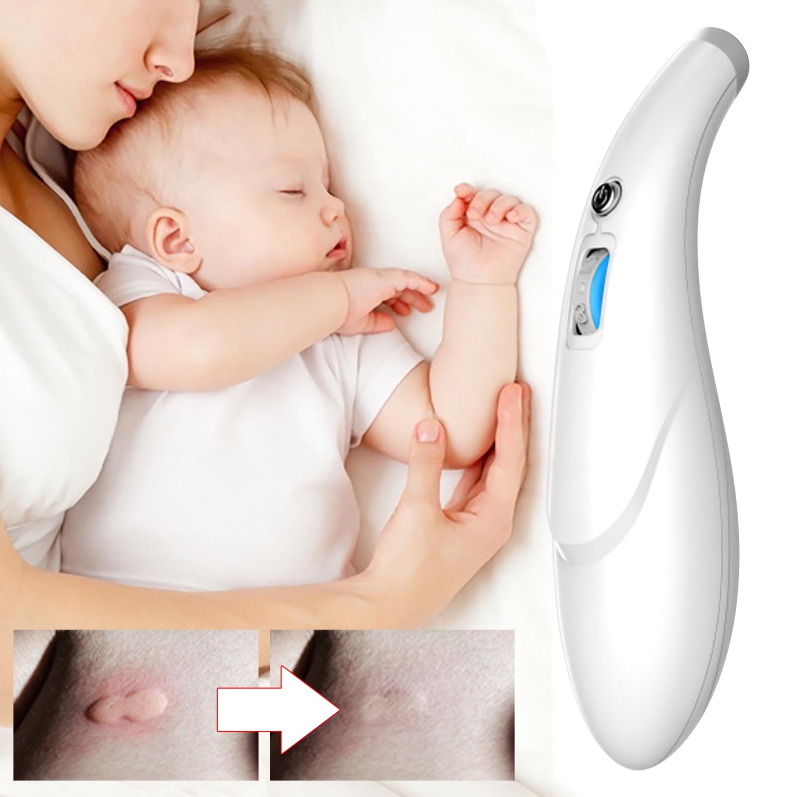 Ein Baby schläft, während eine Mutter es hält. Ein weißes Gerät und Hautbilder sind daneben.