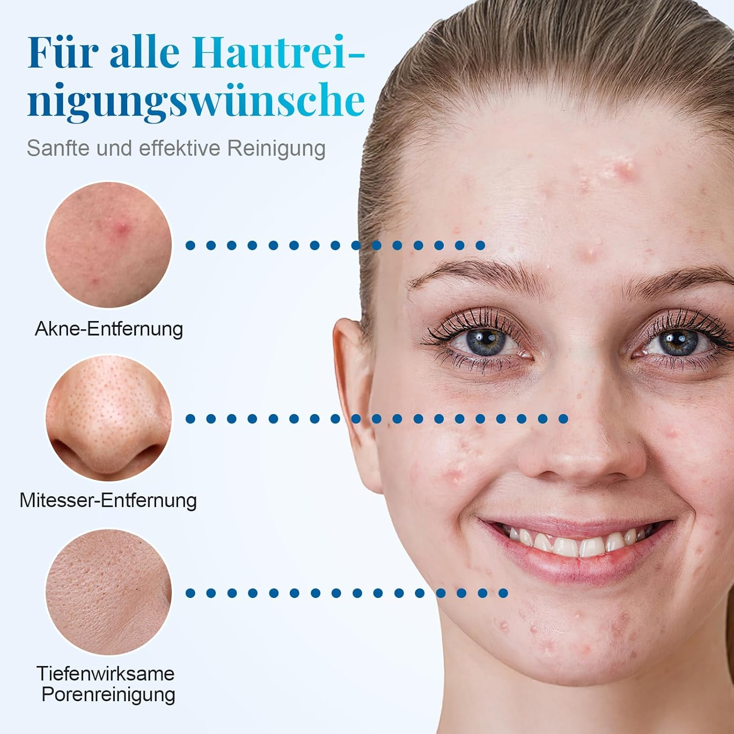 Gesicht mit Hautunreinheiten, daneben Nahaufnahmen von Akne, Mitessern und Poren.