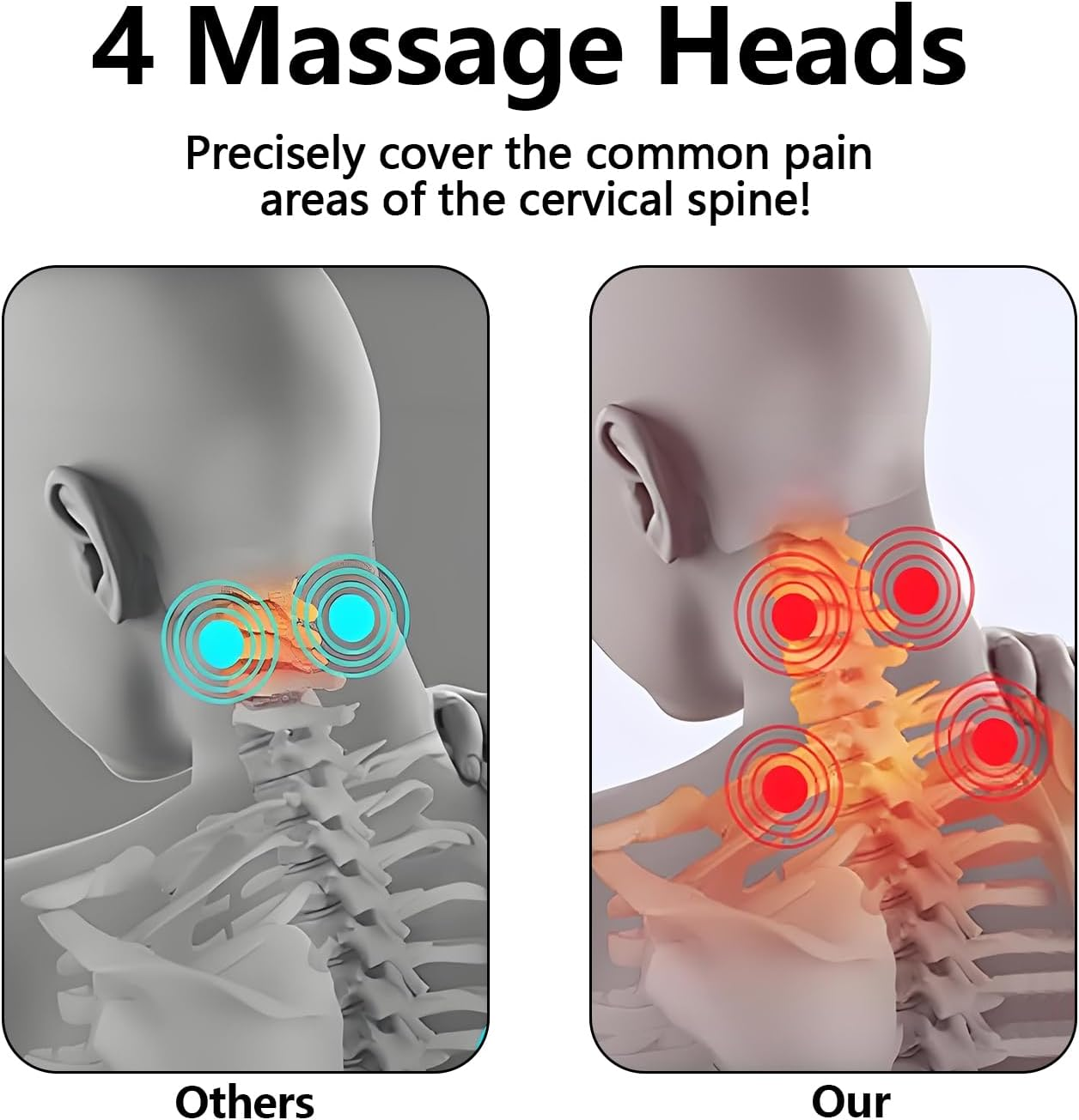 Vergleich von Nacken-Massageköpfen: Links 'Andere' mit 2 blauen Kreisen, rechts 'Unsere' mit 4 roten Kreisen.