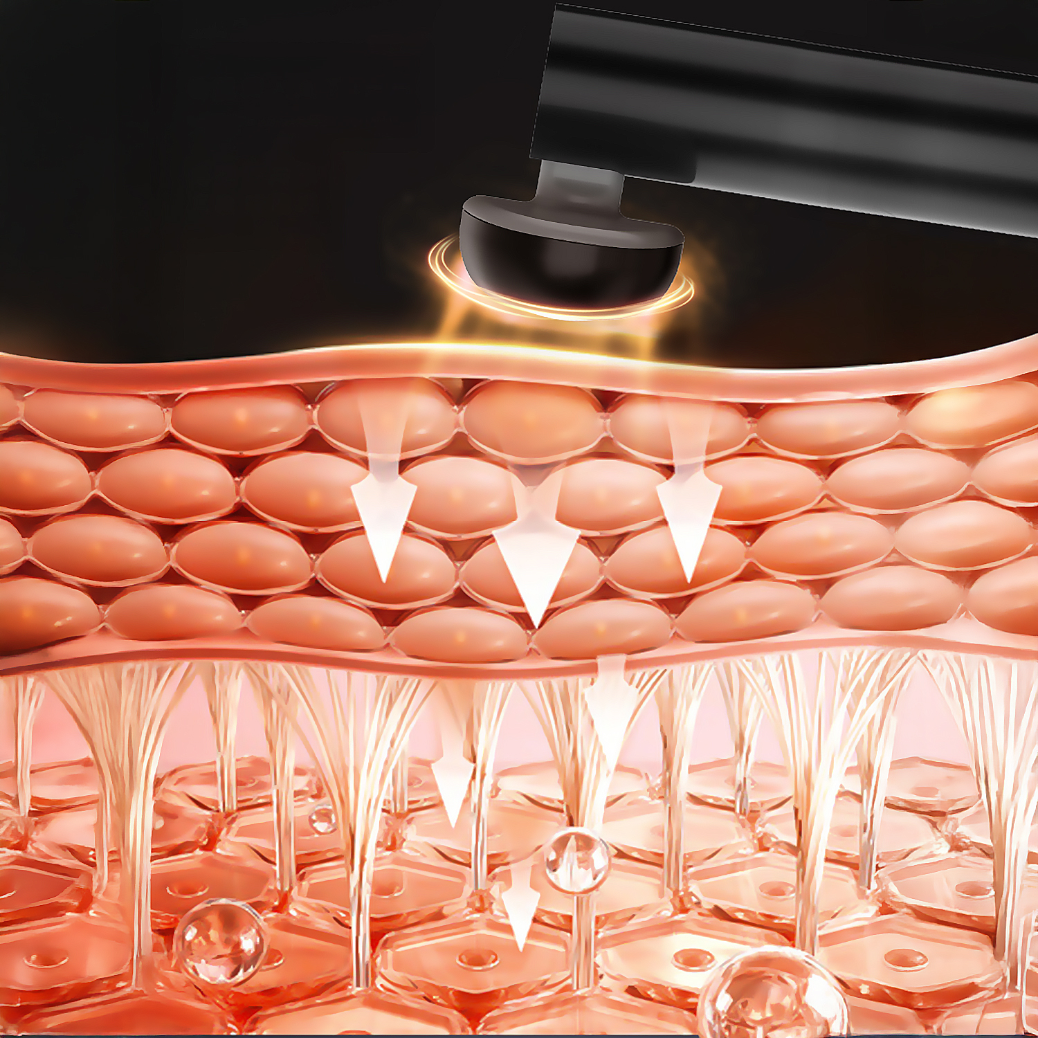 Un dispositivo tratta strati di pelle con energia che penetra nelle cellule.