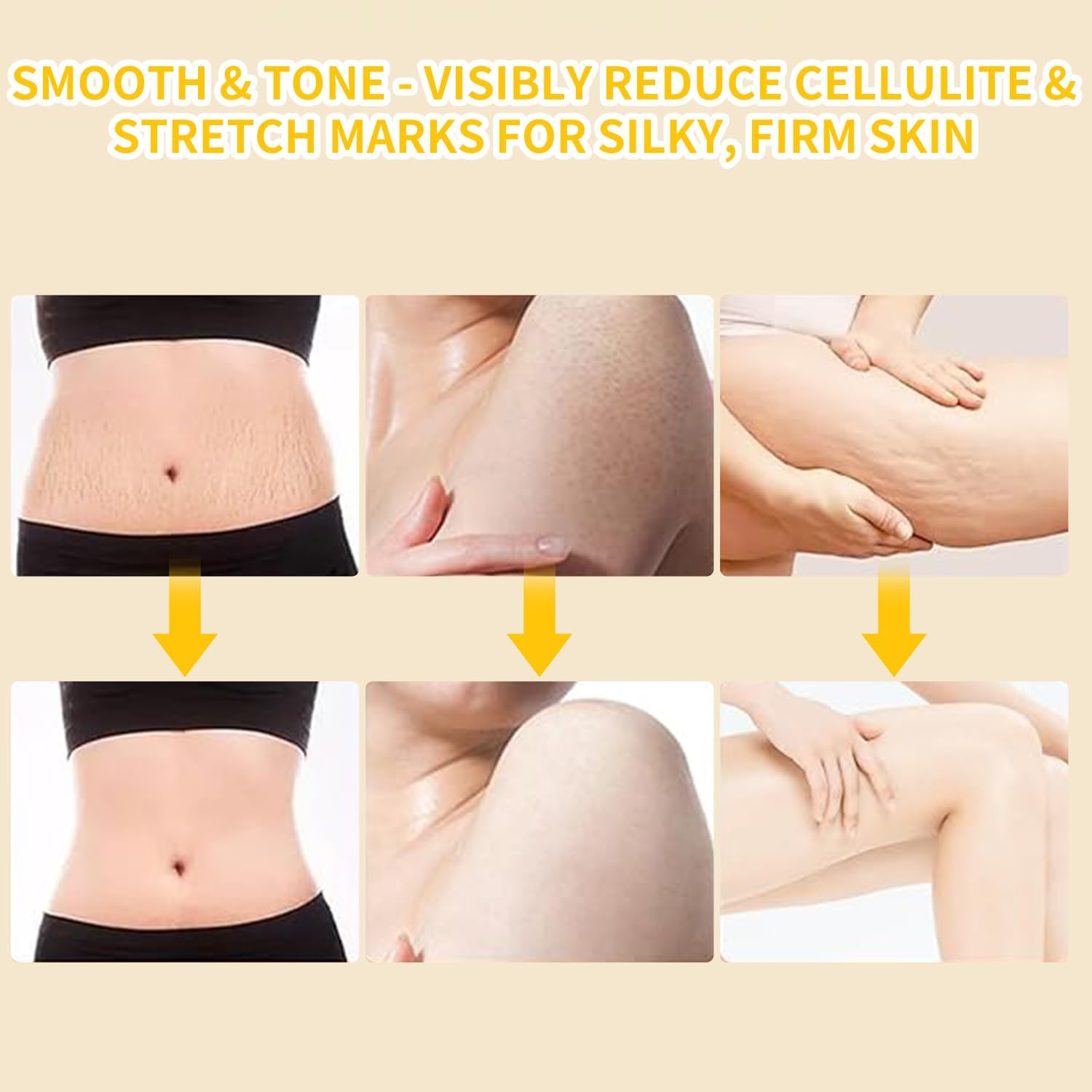 Vorher/Nachher-Bilder von Haut mit Dehnungsstreifen und Cellulite, die glatter wird.