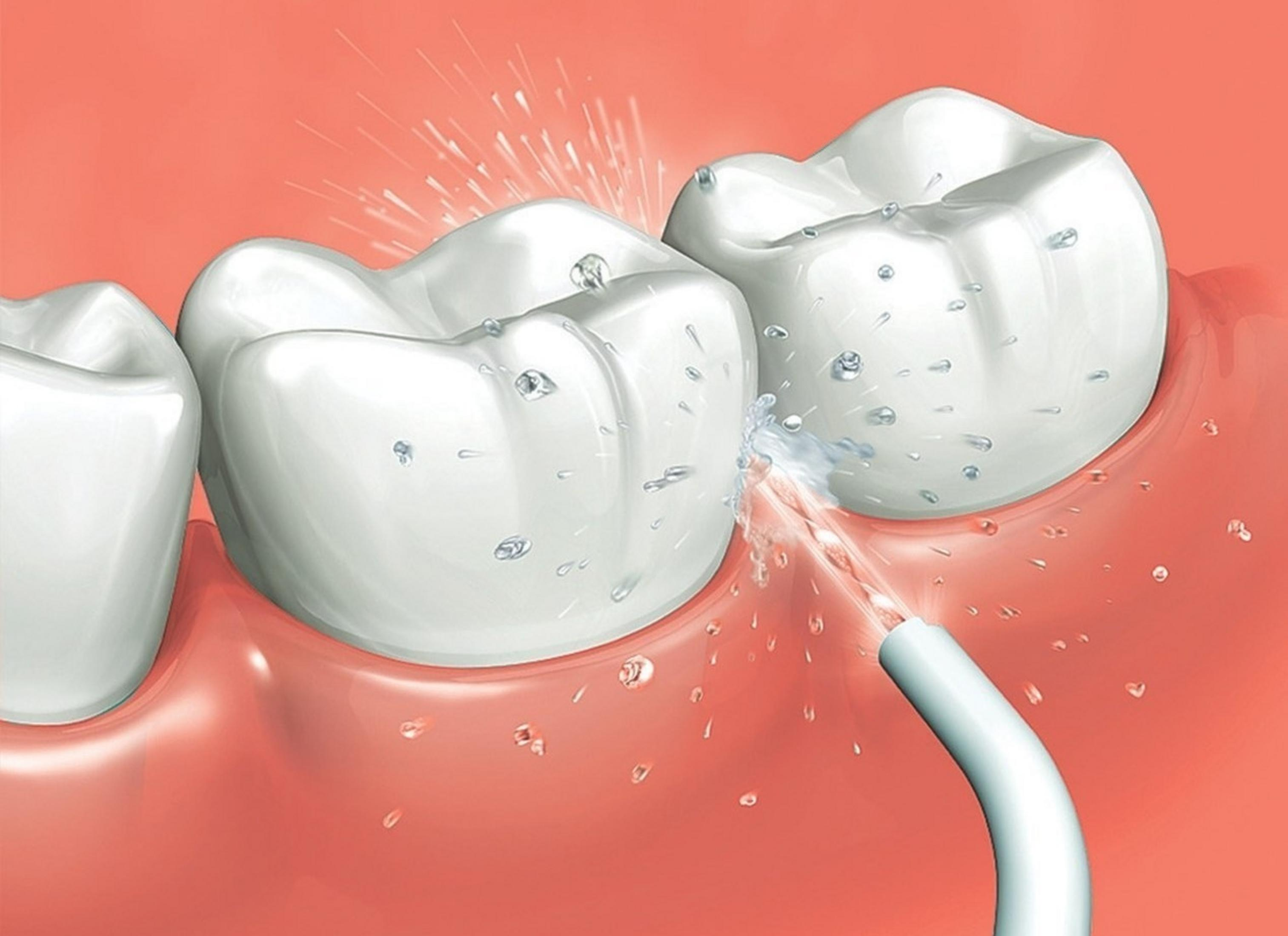 Un jet d'eau nettoie les dents et les gencives avec des éclaboussures.