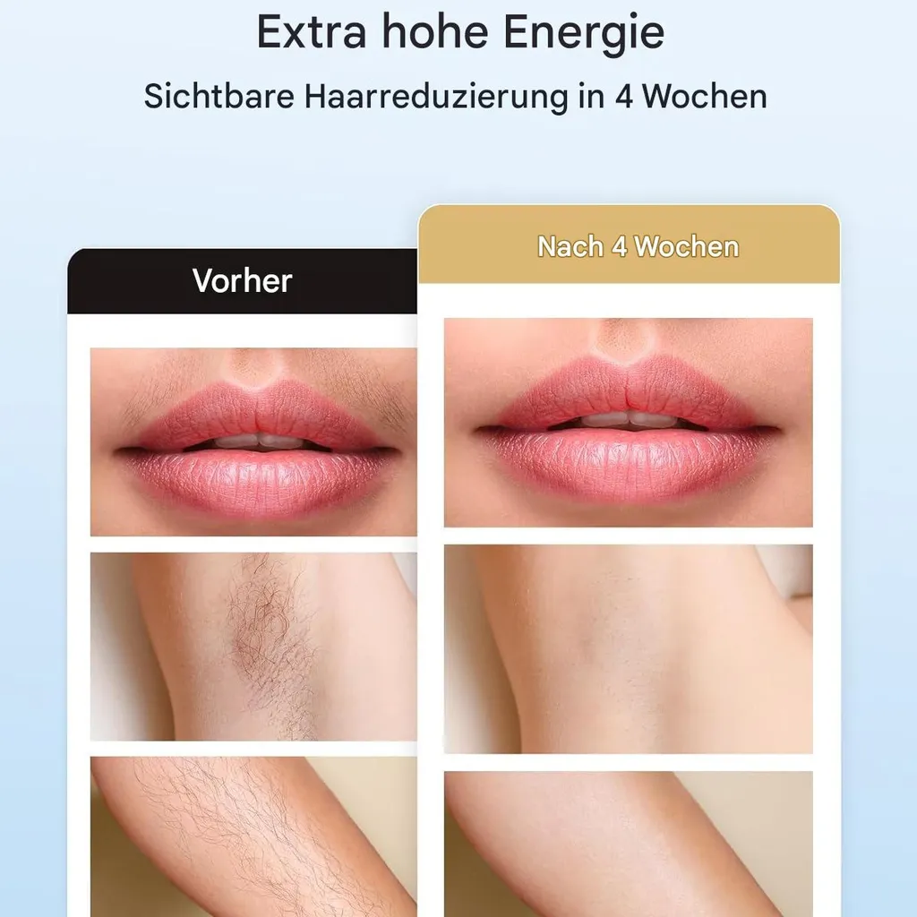 Vorher/Nachher-Bilder von Haarentfernung an Lippen, Achseln und Armen.