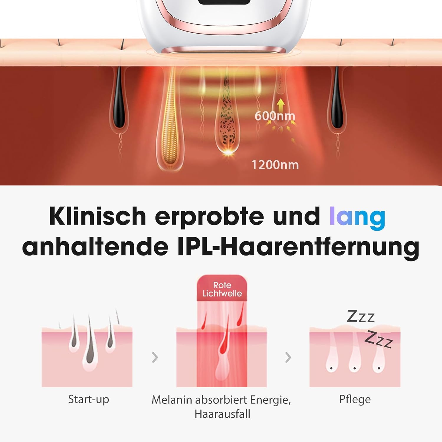 IPL-Haarentfernung: Hautschichten mit Haarfollikeln, Wellenlängen 600/1200nm.
