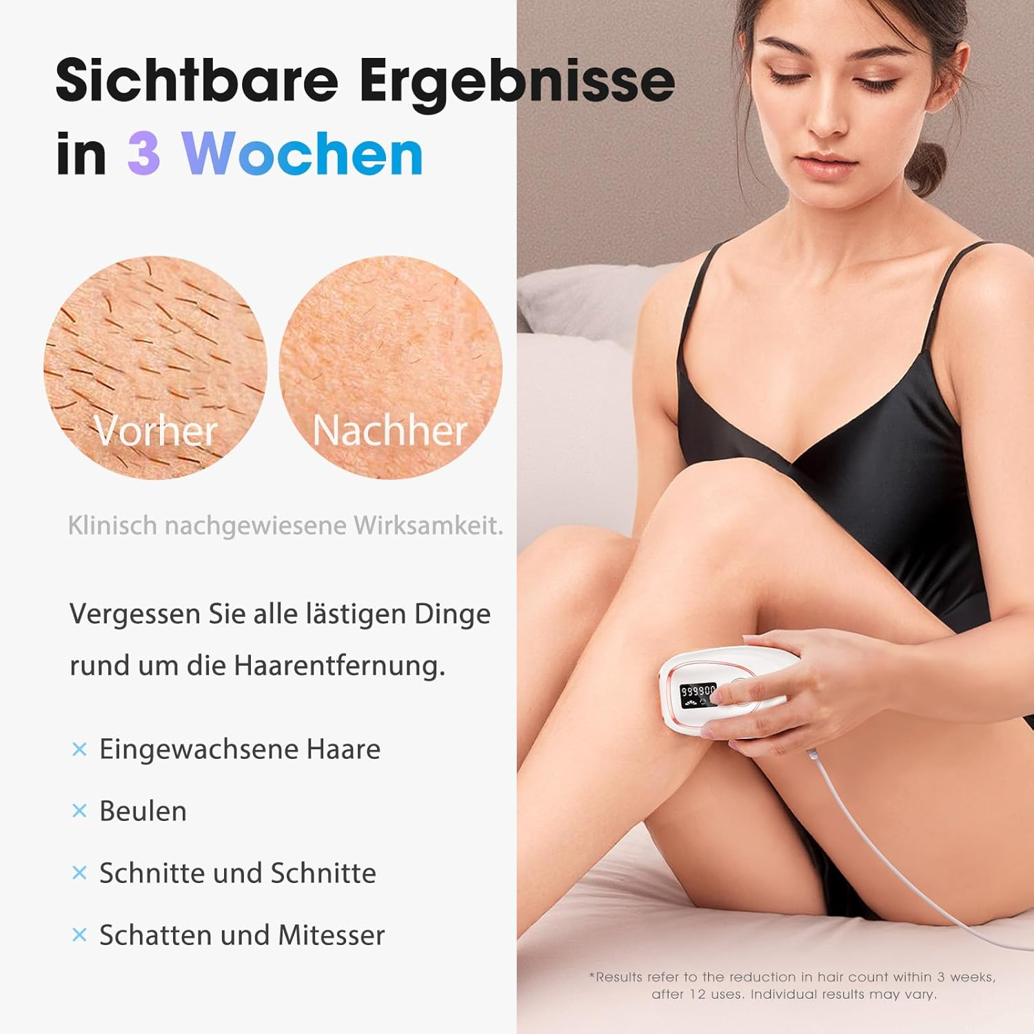 Frau benutzt IPL-Haarentferner auf ihrem Bein, mit Vorher/Nachher-Bildern und Text.