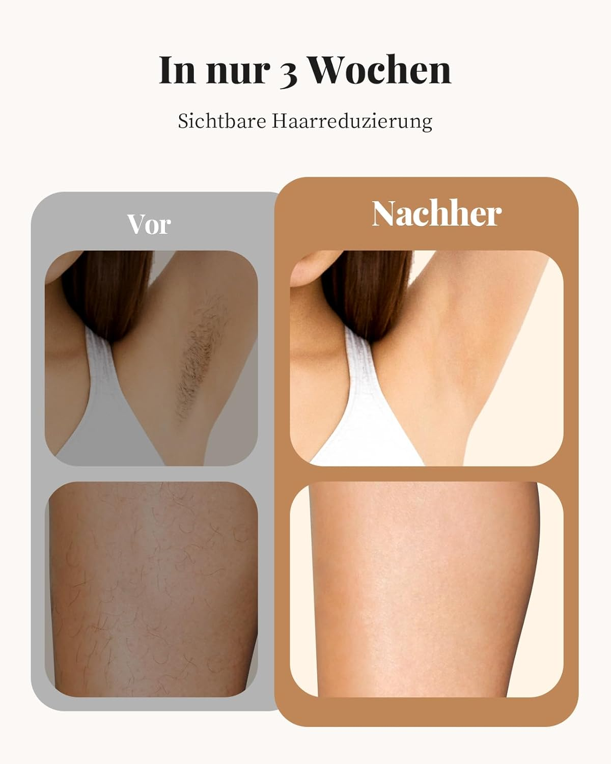 Vorher/Nachher-Vergleich von Körperhaaren an Achseln und Beinen.
